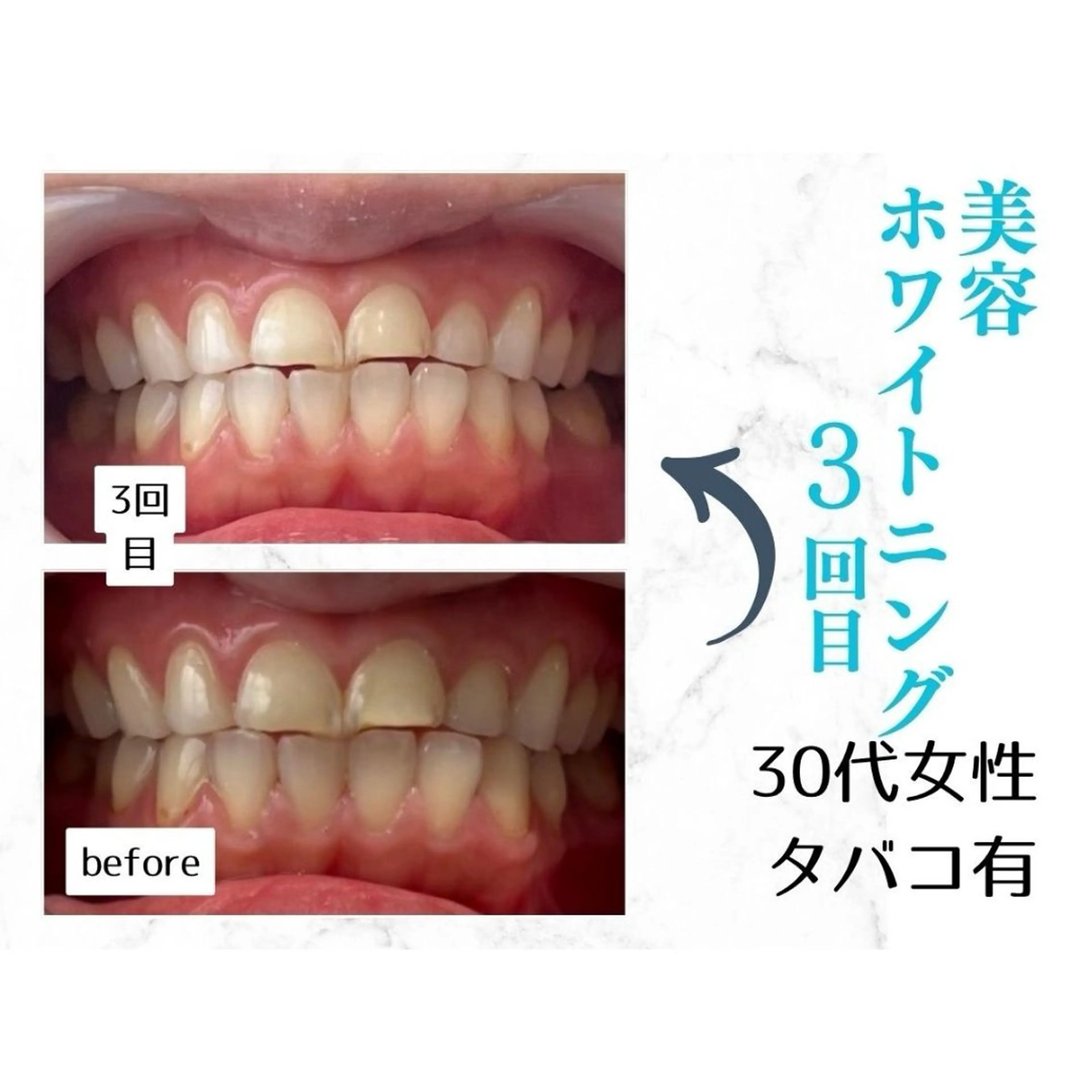 ホワイトニングサロン le  canonのその他イメージ