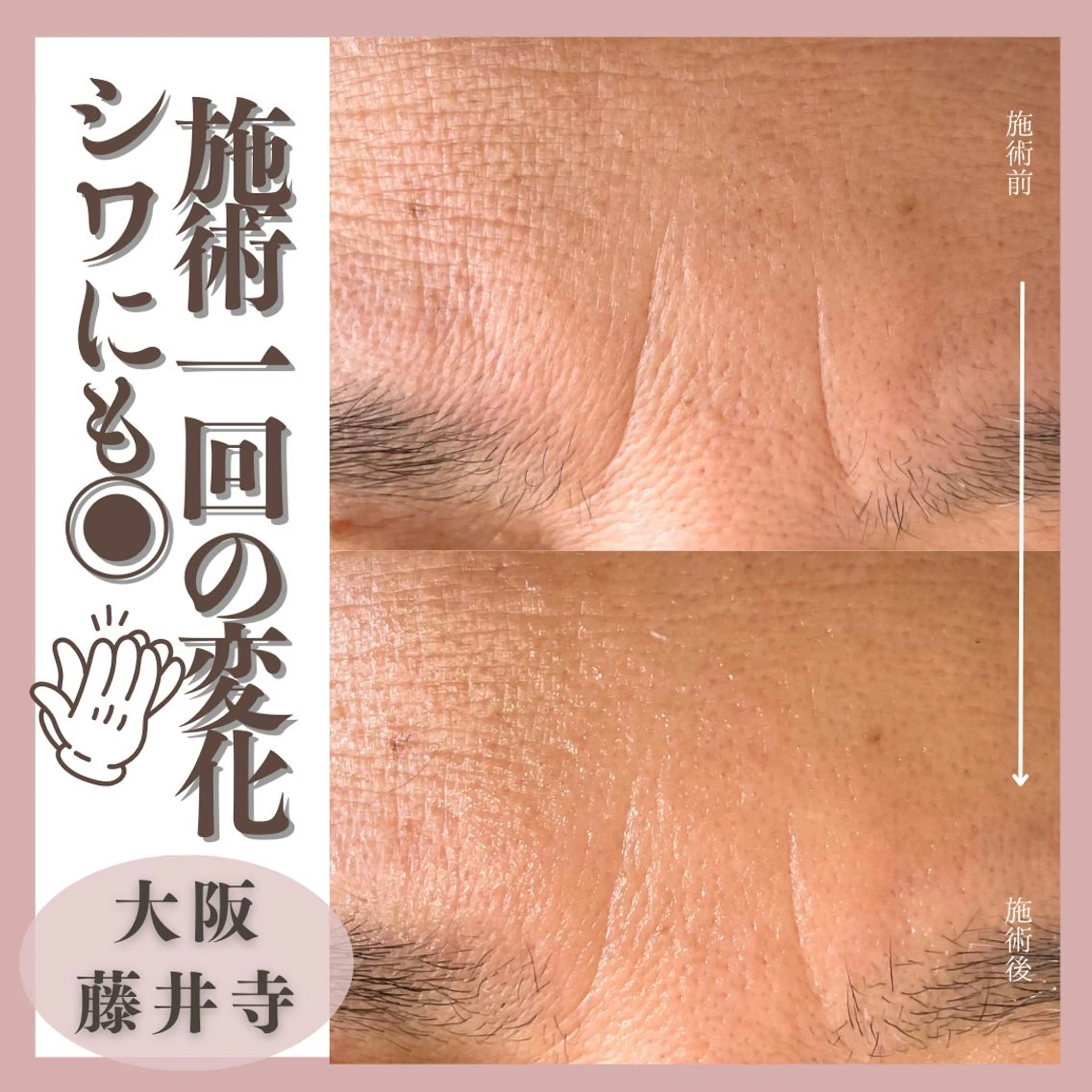 脱毛 Muqu.所属・Muqu. 毛穴サロンのエステ・リラクイメージ