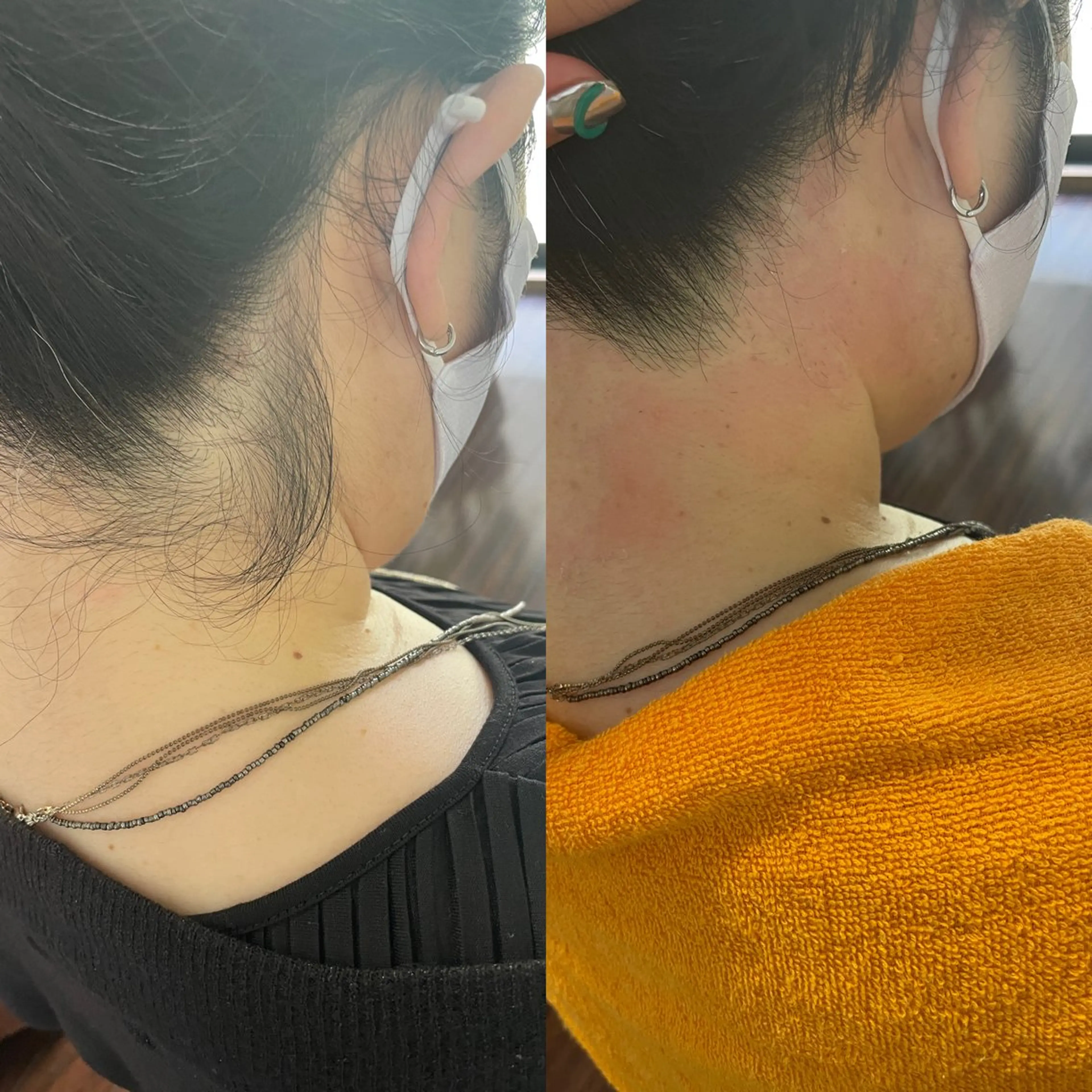 《☆施術時間10分☆》　　　　　　　　　　　　　　　　　　　　　　　　　　うなじwax脱毛の写真