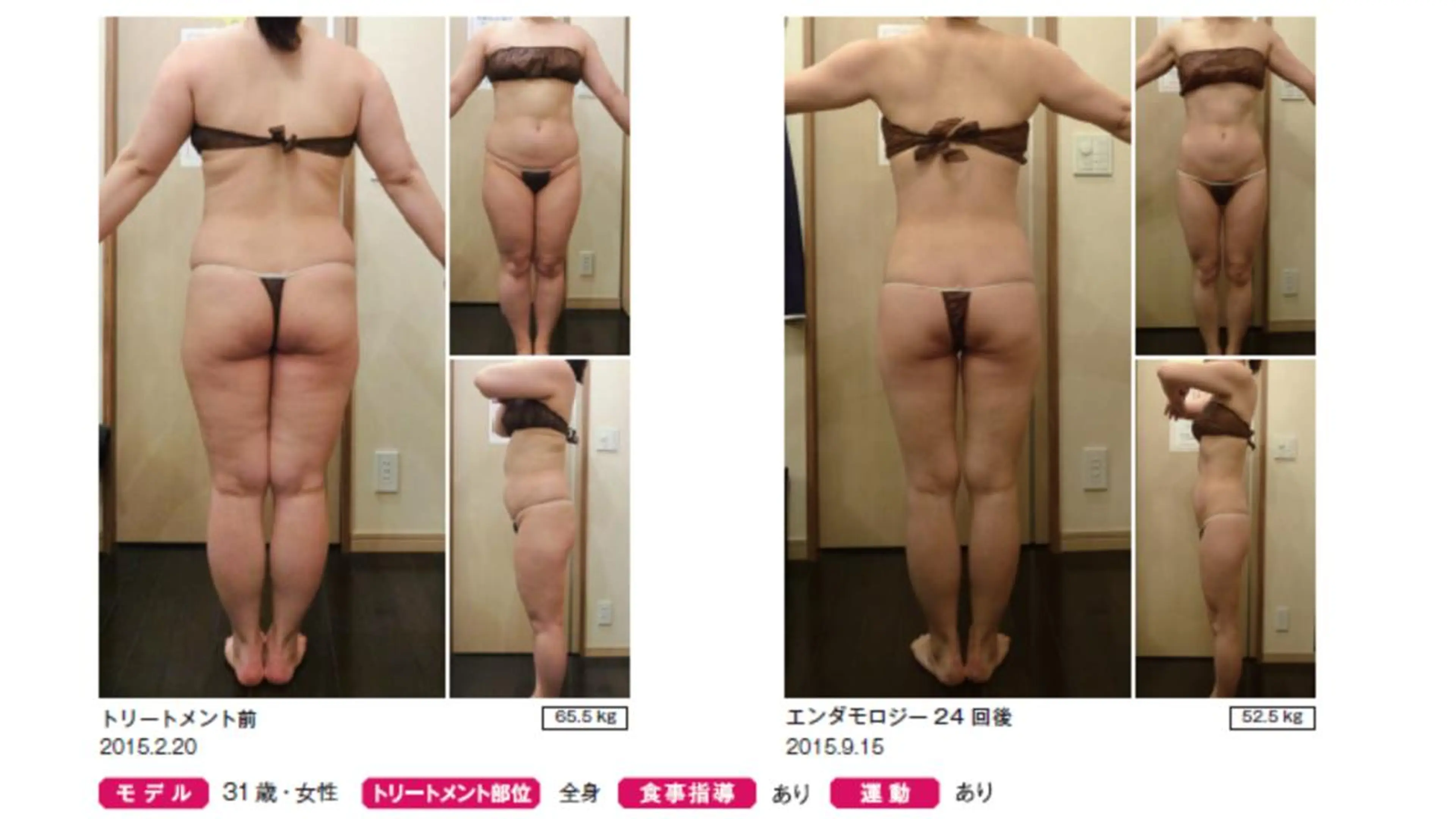 オレンジバナナ 県央店のエステ・リラクイメージ