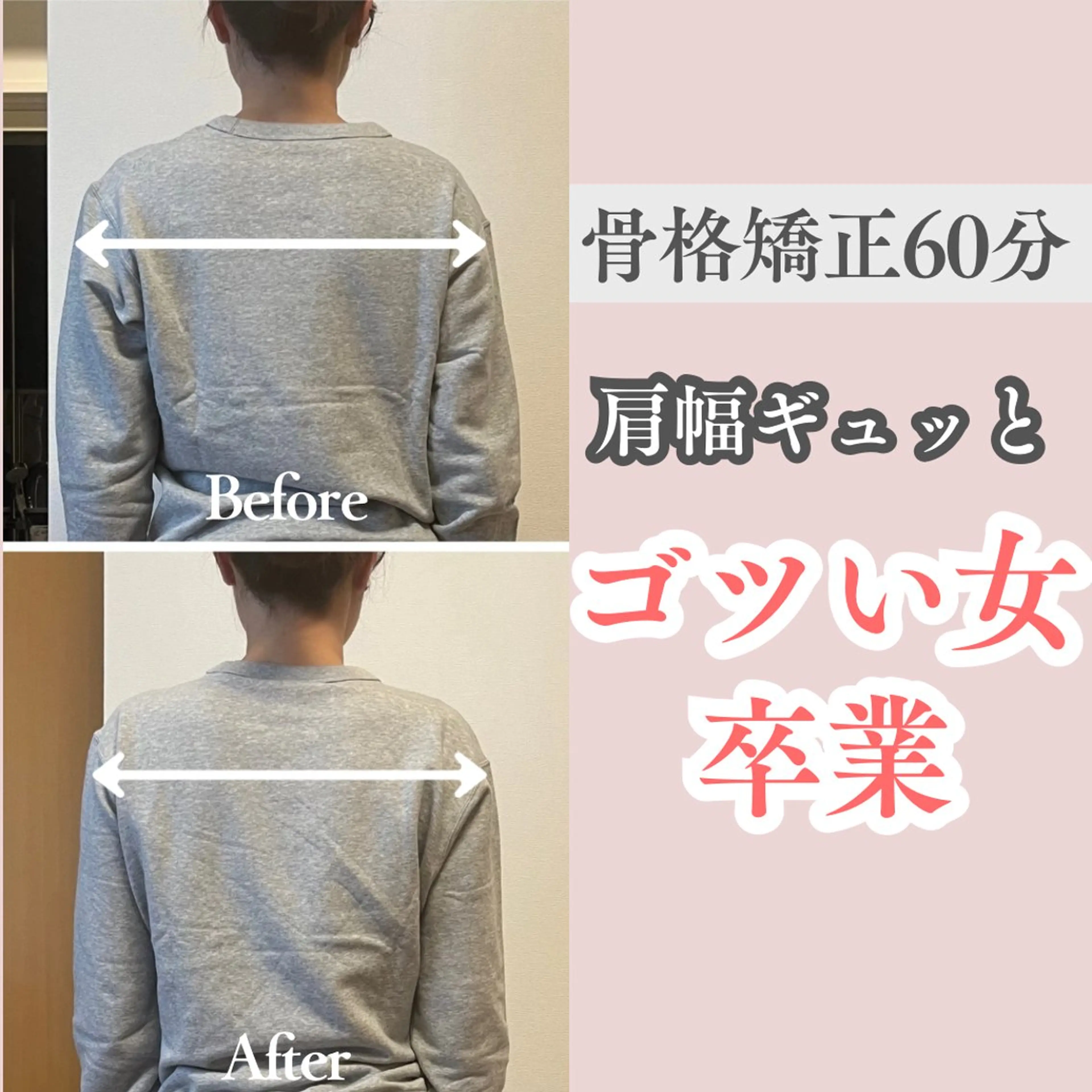 小顔矯正/骨格矯正 AKANEのエステ・リラクイメージ