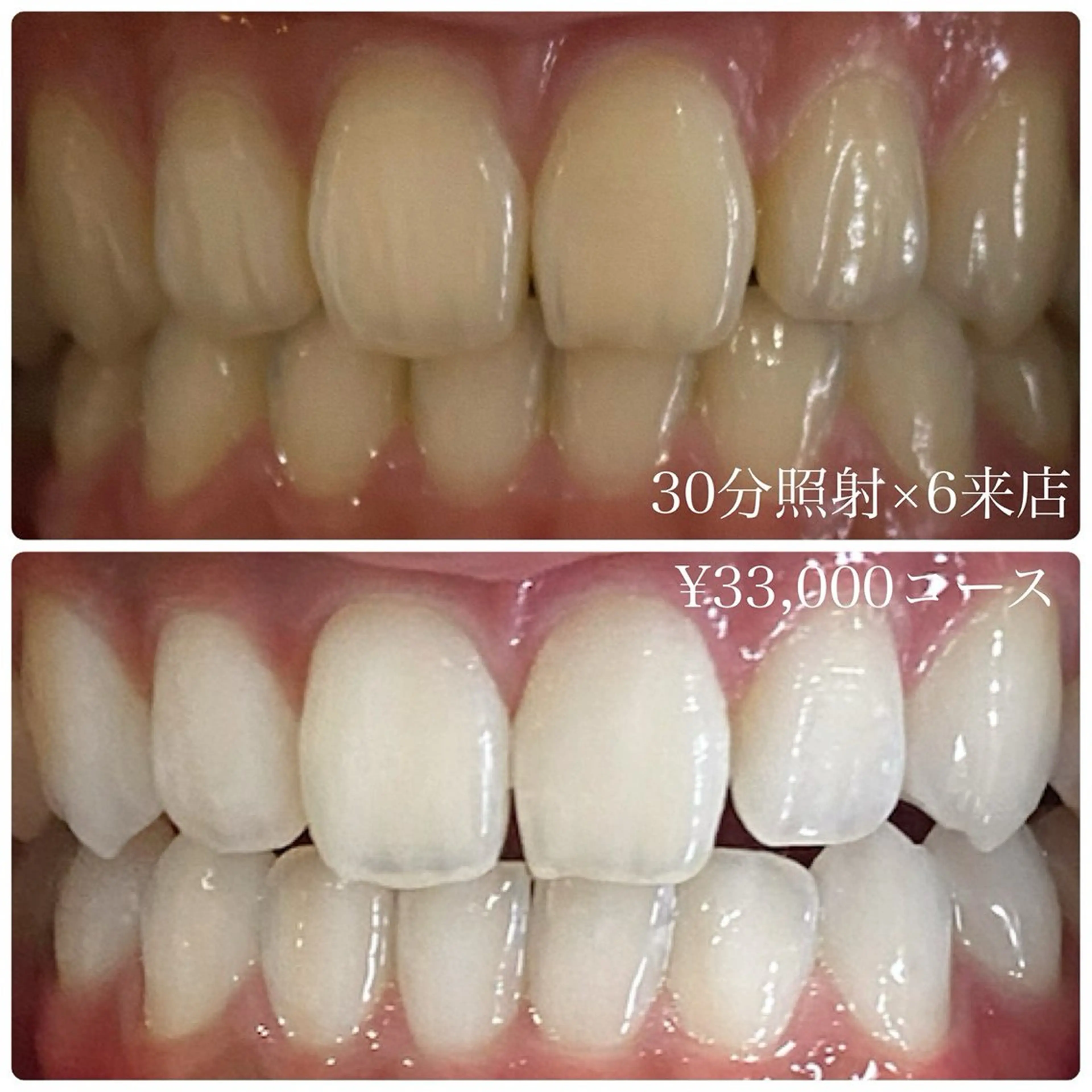 その他 PLATINUM Beauty 横浜店所属・ホワイトニングルーム 横浜店のその他イメージ