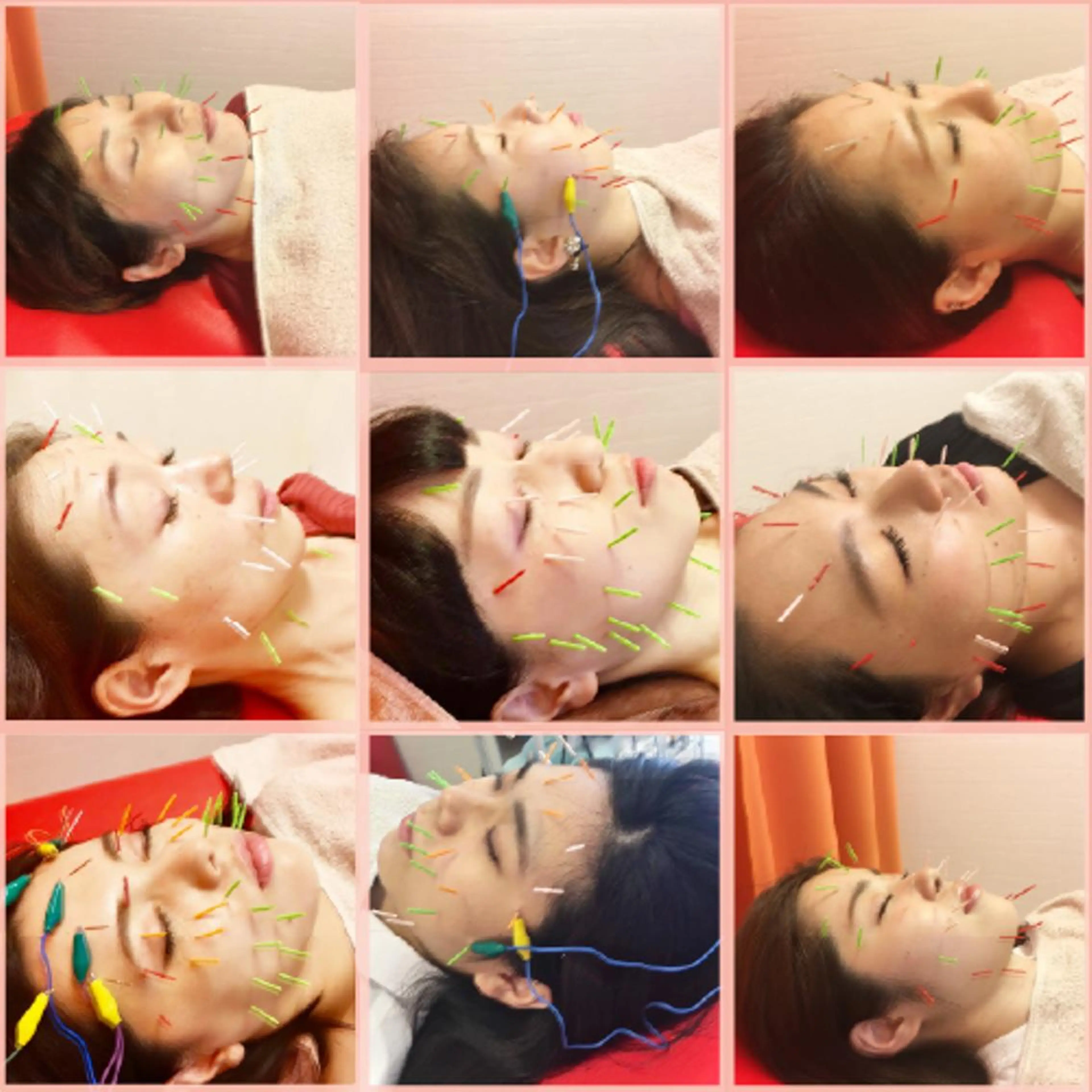 🌈 肌質改善 🙌 美容鍼 ヒロキ🌈のエステ・リラクイメージ