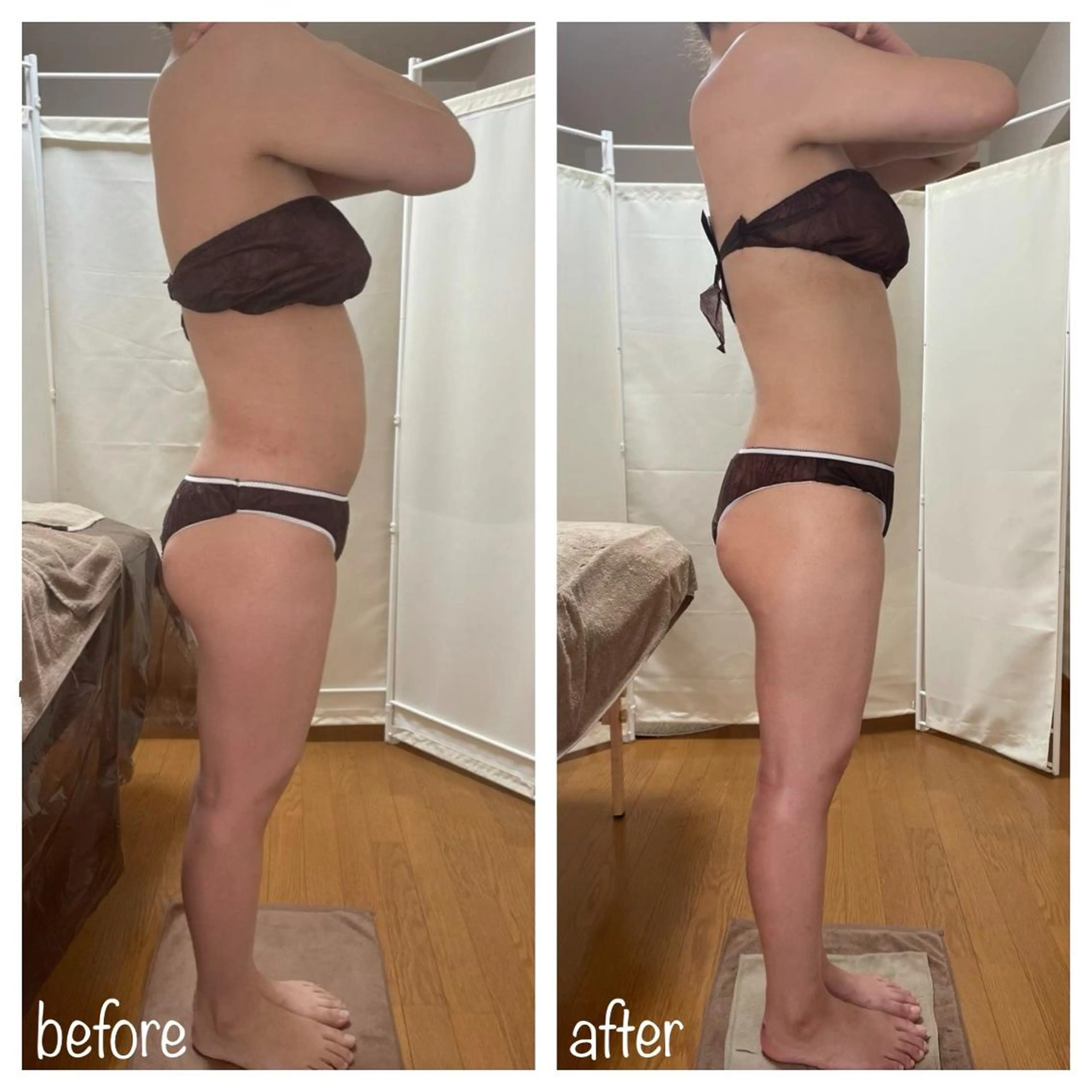 biloop所属・《痩身×疲労改善》 BILOOPのエステ・リラクイメージ