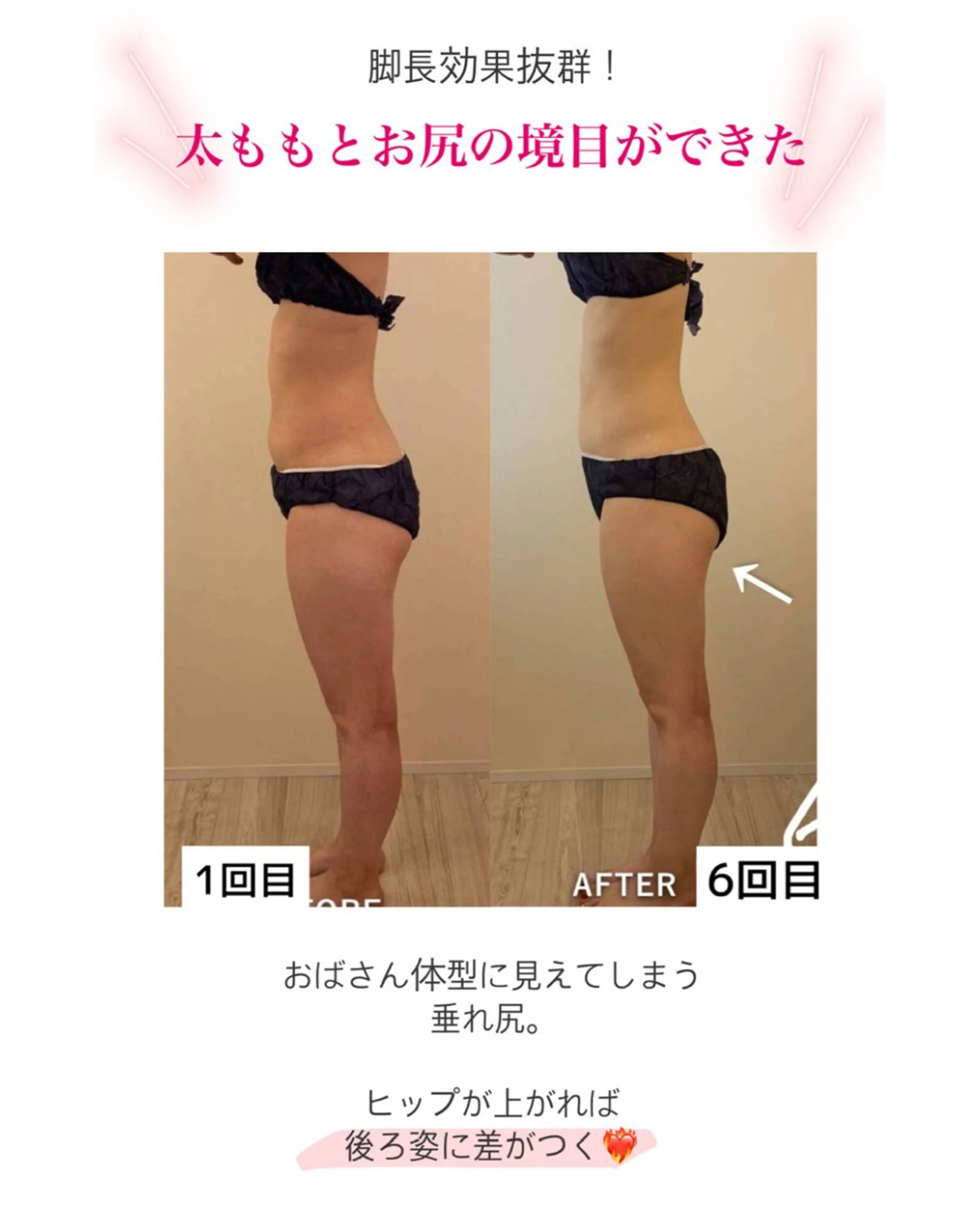 産後ダイエット−9㎏ Pourvous結衣のエステ・リラクイメージ