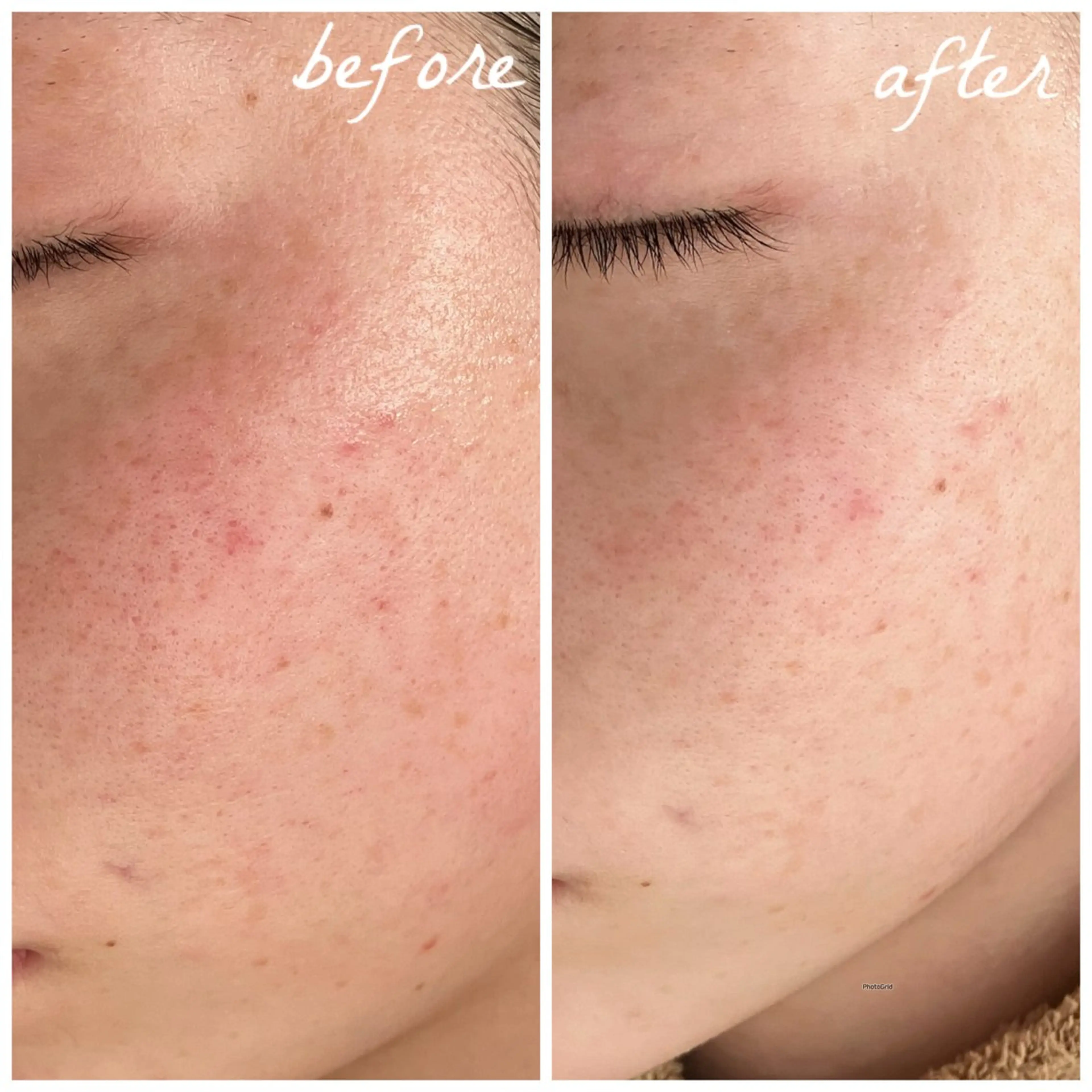 メンズ エステ メナード岐阜茜部 杉浦のエステ・リラクイメージ