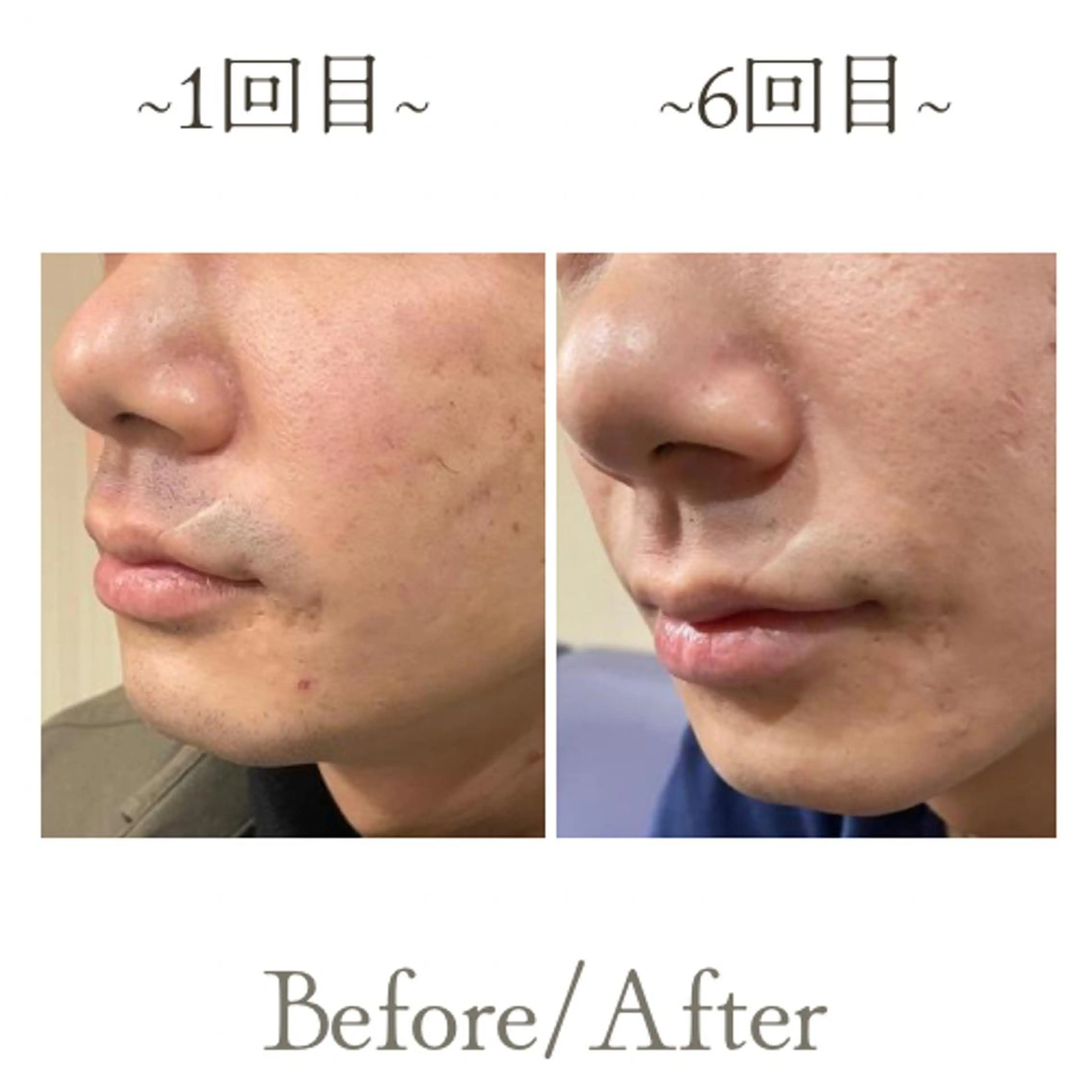 脱毛 メンズサロンGRACE所属・salon GRACEのエステ・リラクイメージ