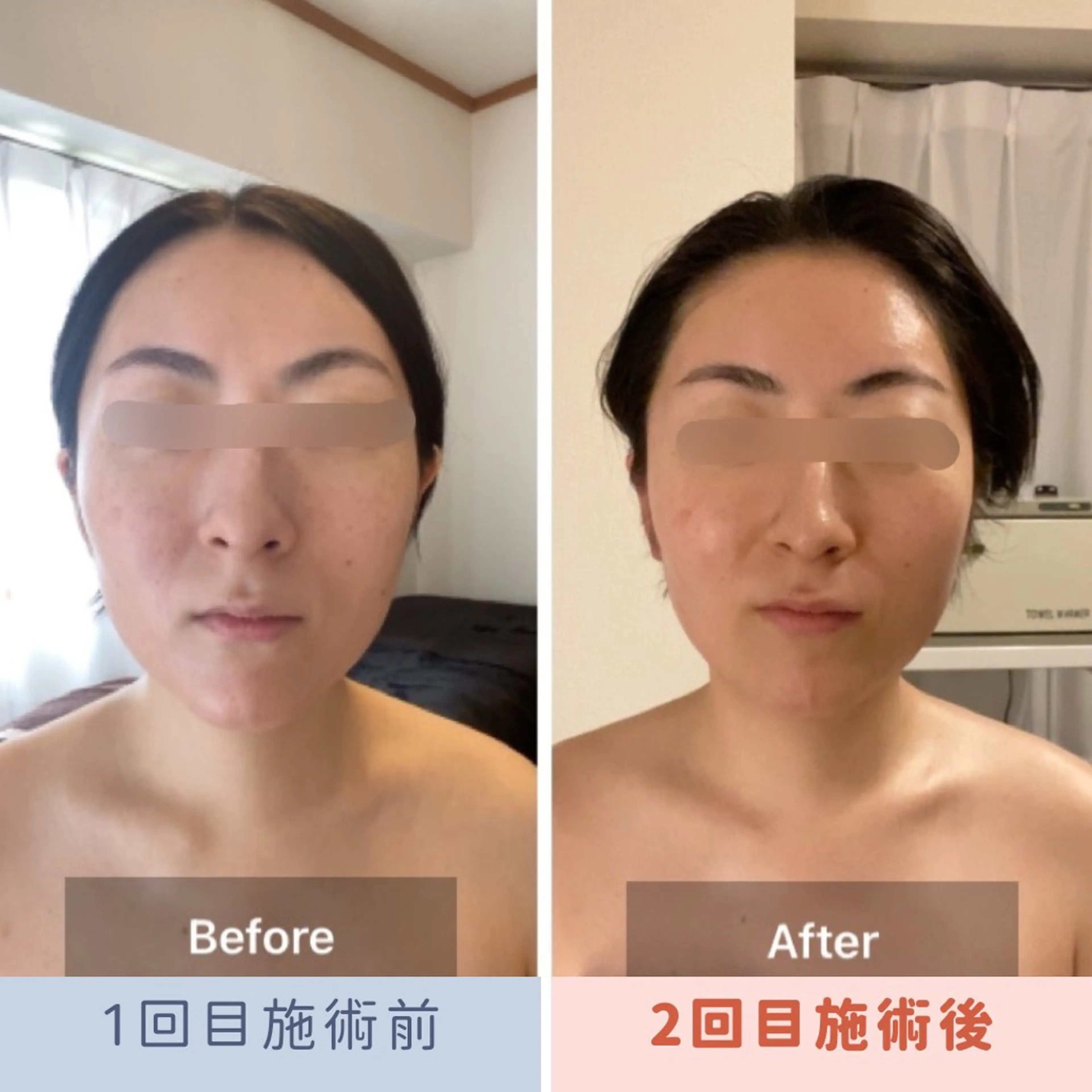 眉毛×小顔矯正サロン パピヨンsakiのエステ・リラクイメージ