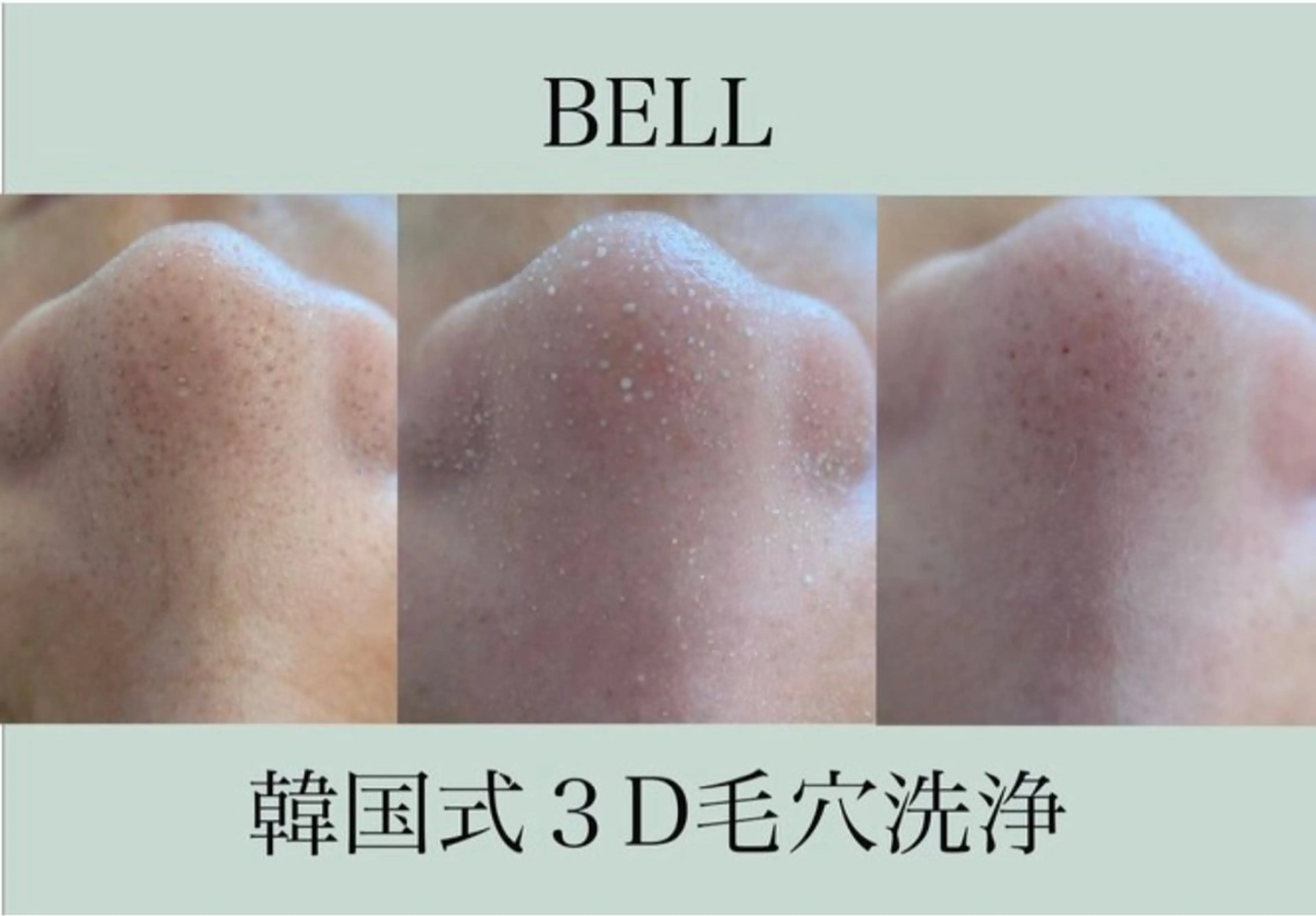 練習モデル【韓国式3D毛穴洗浄×高濃度ビタミンC】相性抜群の組み合わせ🍋毛穴の引き締め効果をUP⤴️通常27400円！の写真