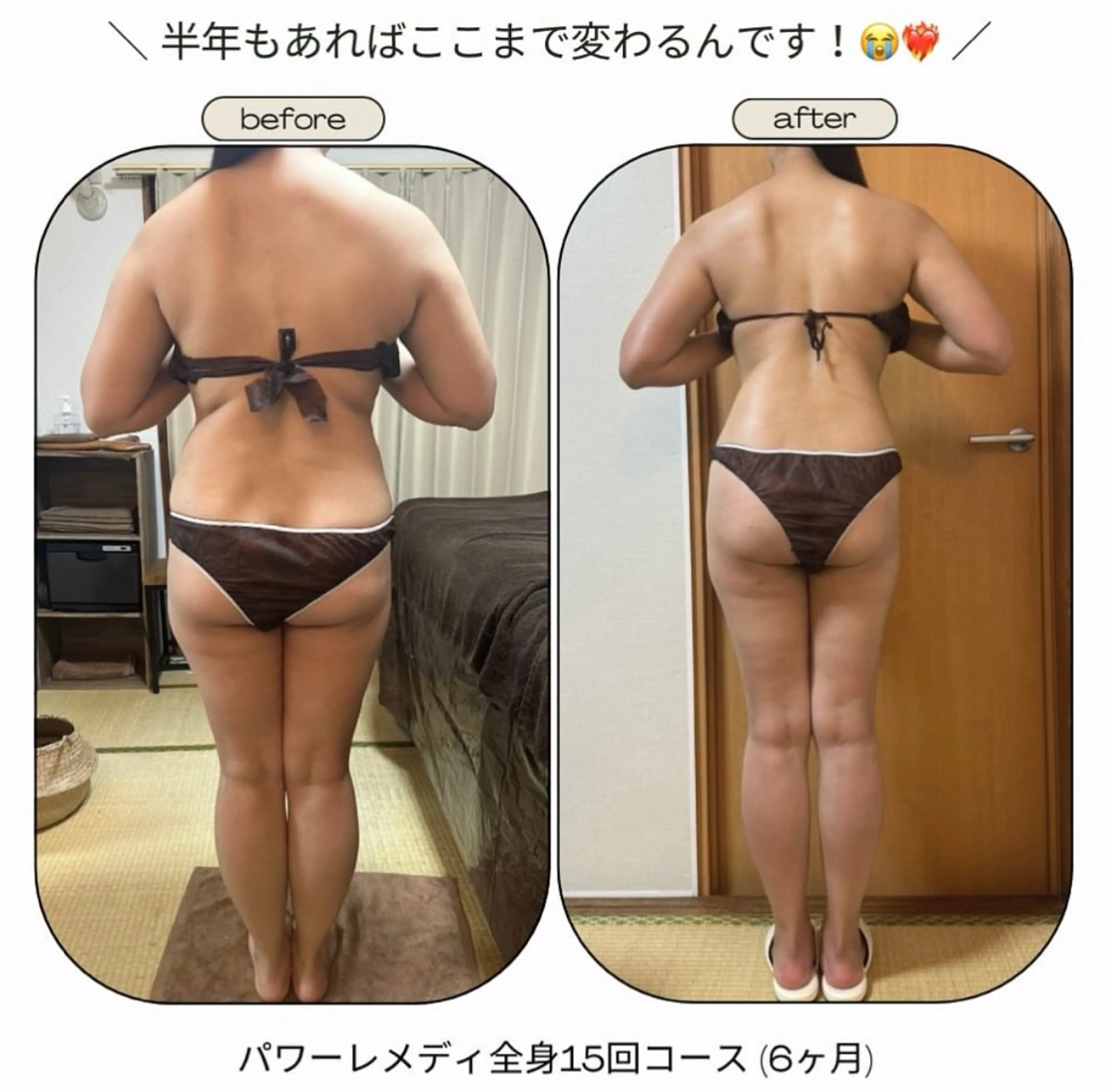 エステ リラク biloop所属・《本気痩せ×疲労改善 》  BILOOPのエステ・リラクイメージ