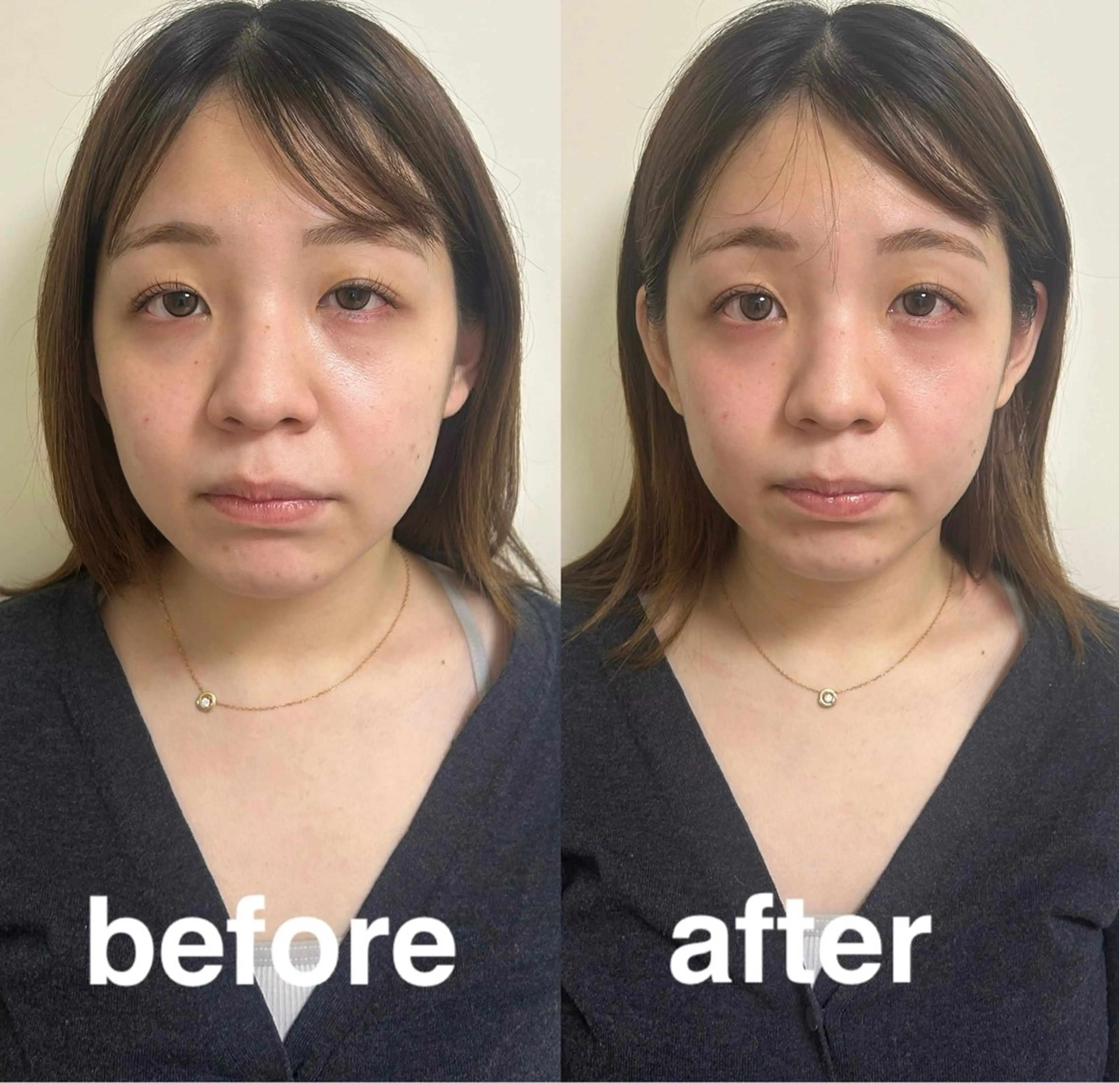 美容鍼灸サロン mahoroba院長のエステ・リラクイメージ