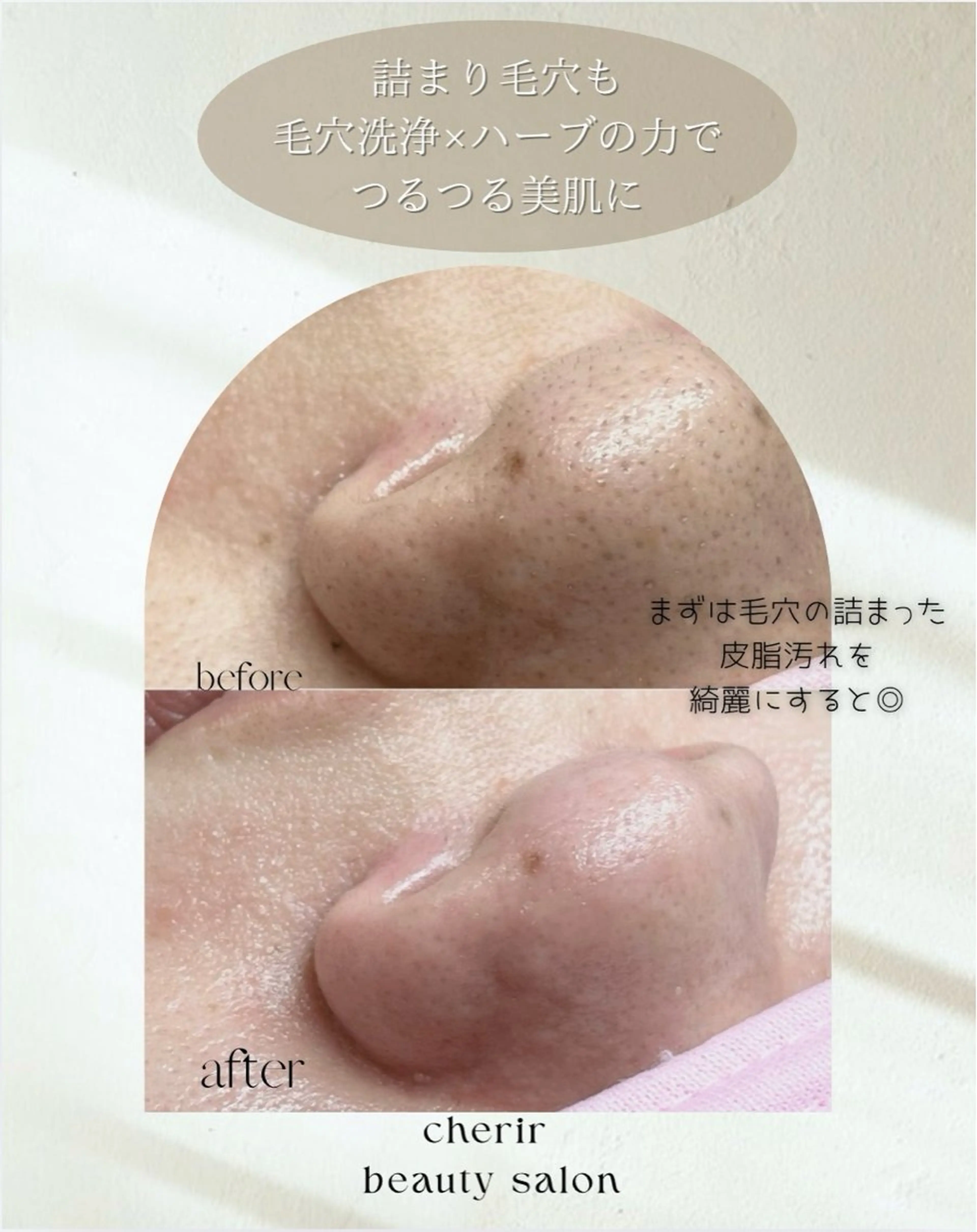 cherir所属・cherir大井町/ 毛穴ニキビ改善専門のエステ・リラクイメージ