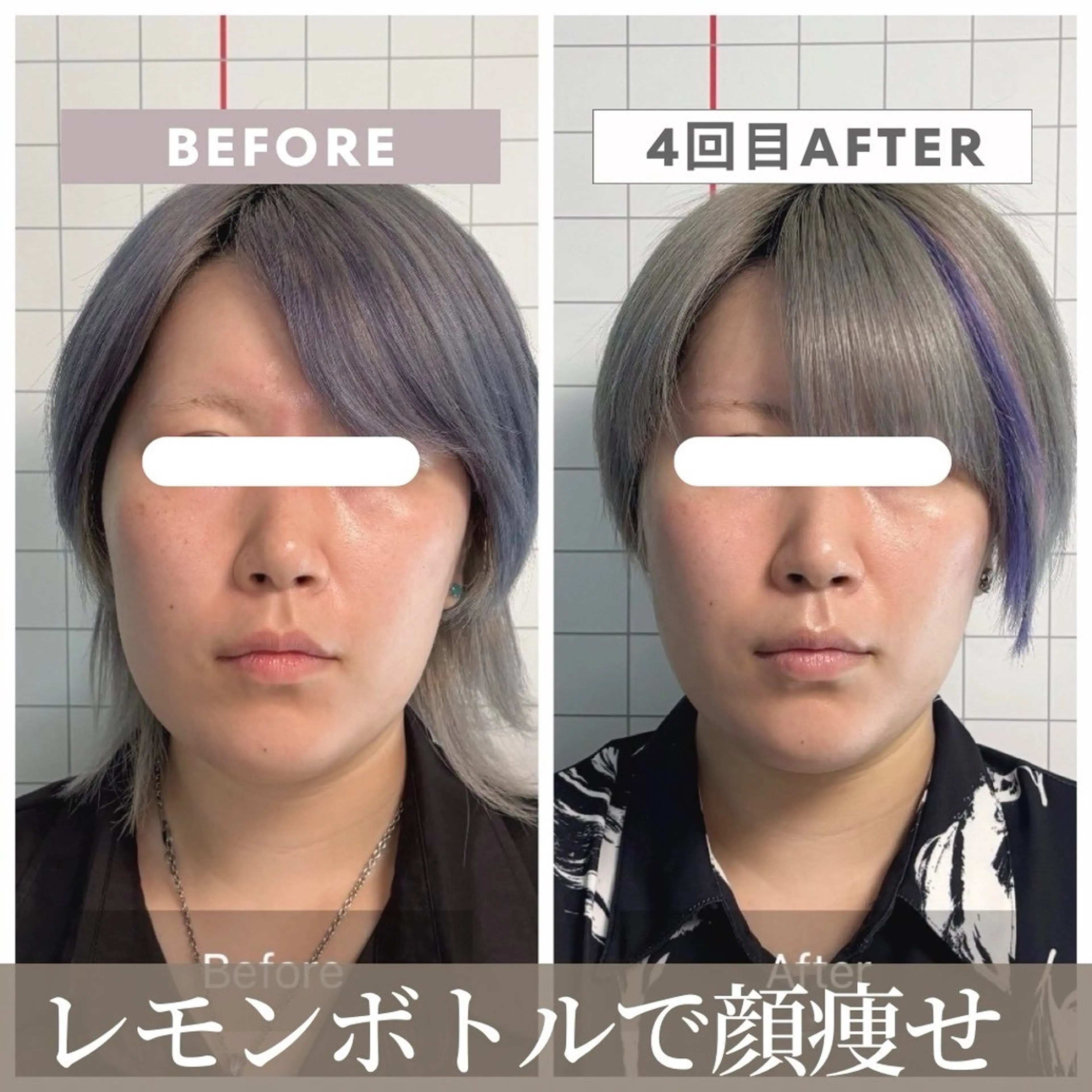 エステ リラク 【小顔リフト×小顔矯正専門店】RED所属・猿渡 ひかるのエステ・リラクイメージ