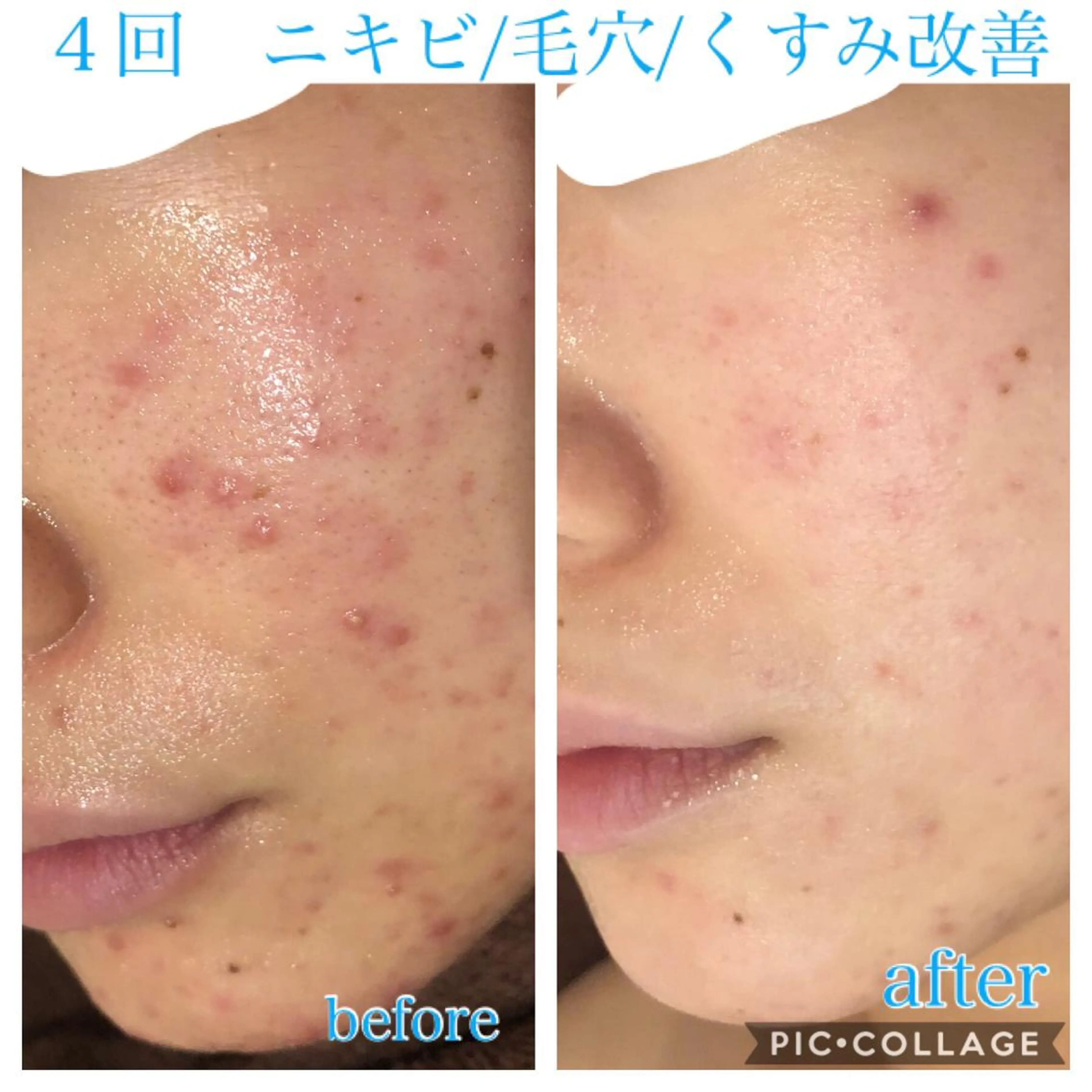 セミロング カラー パーマ ヘアアレンジ メンズ キッズ ネイル マツエク・マツパ エステ リラク Ensor Clair所属・EnsorClair 代表　野口真央のエステ・リラクイメージ