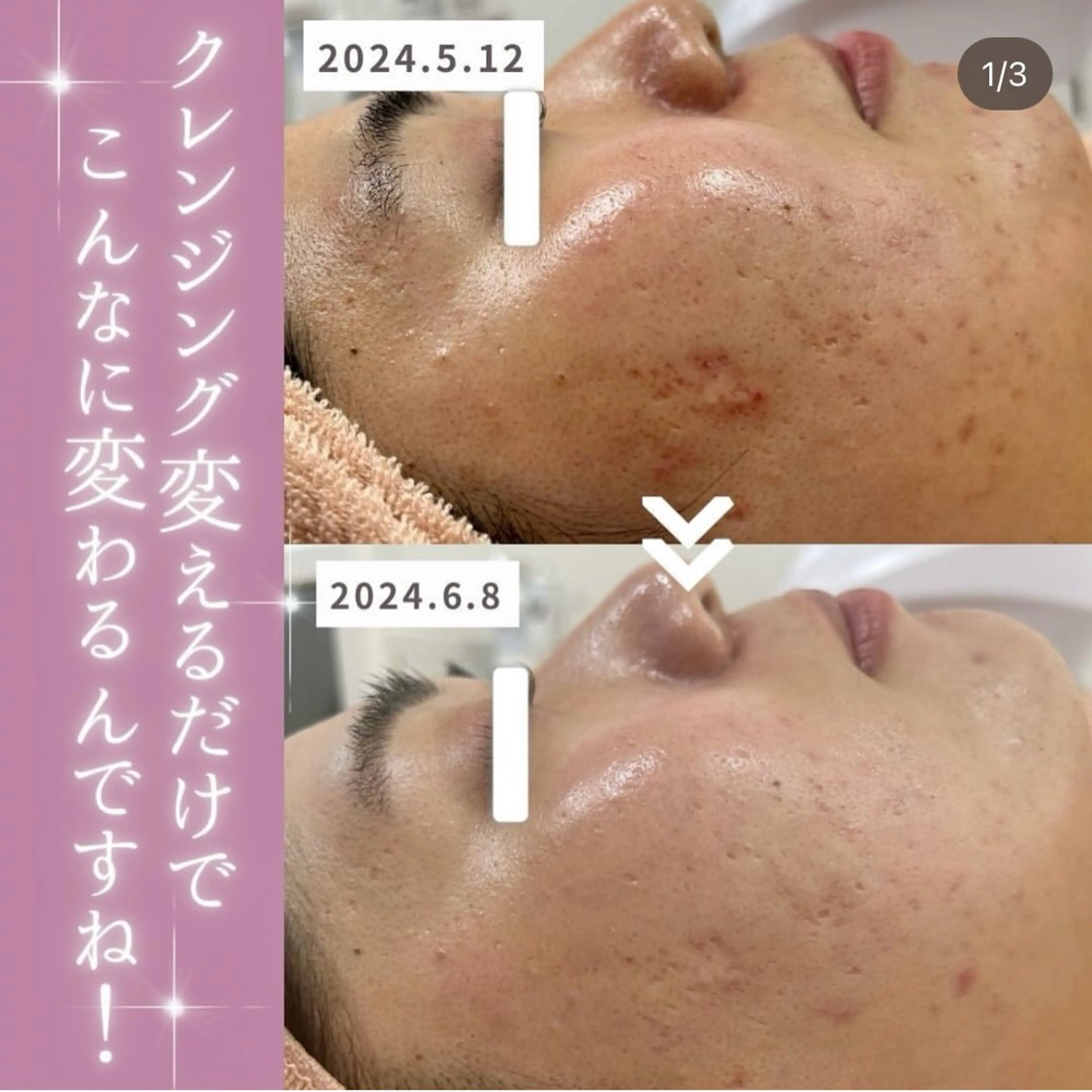 エステ 【現役看護師】高来 笑子のエステ・リラクイメージ