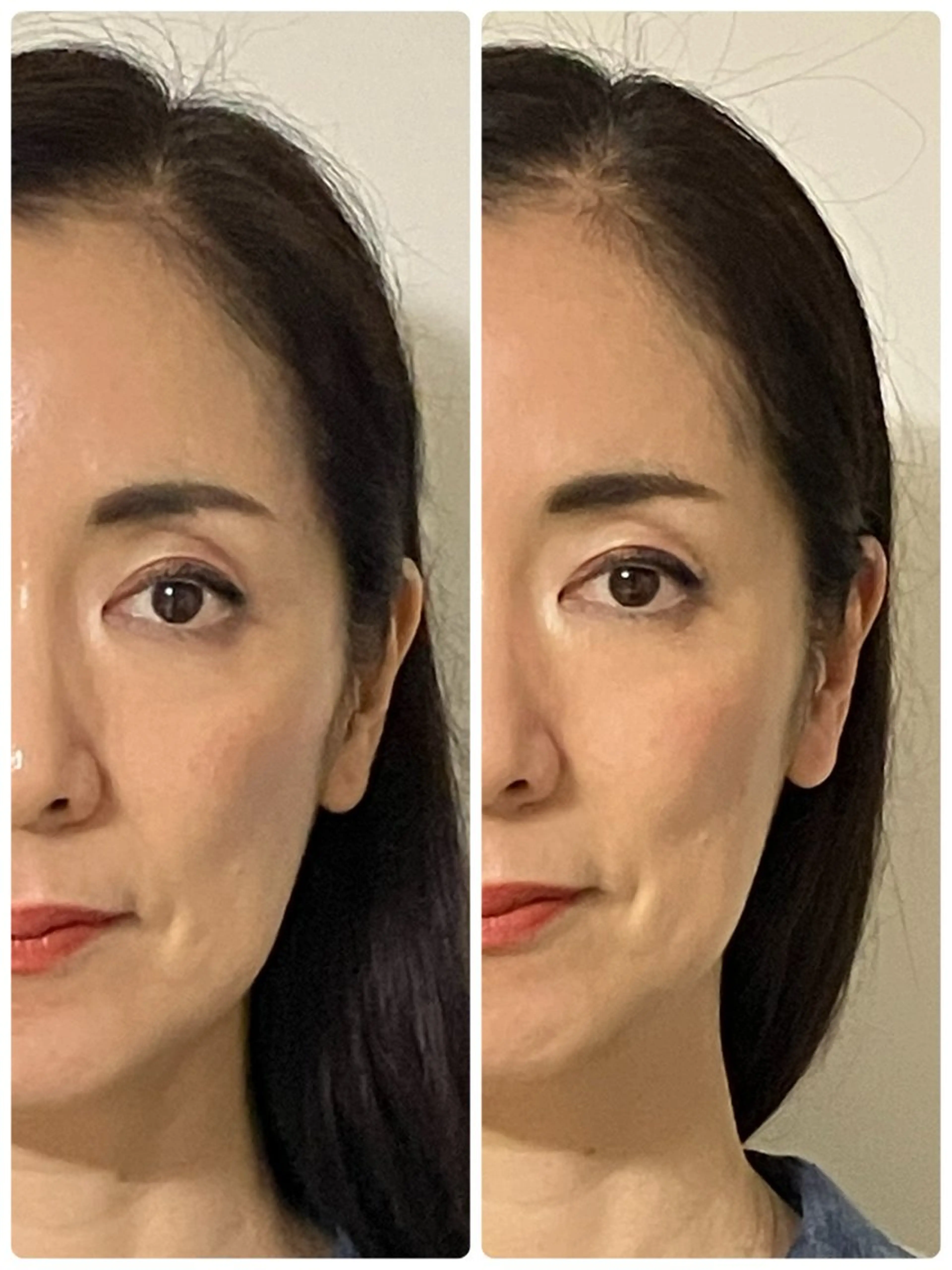 💆‍♀️【45分】極上小顔ドライヘッドスパの写真