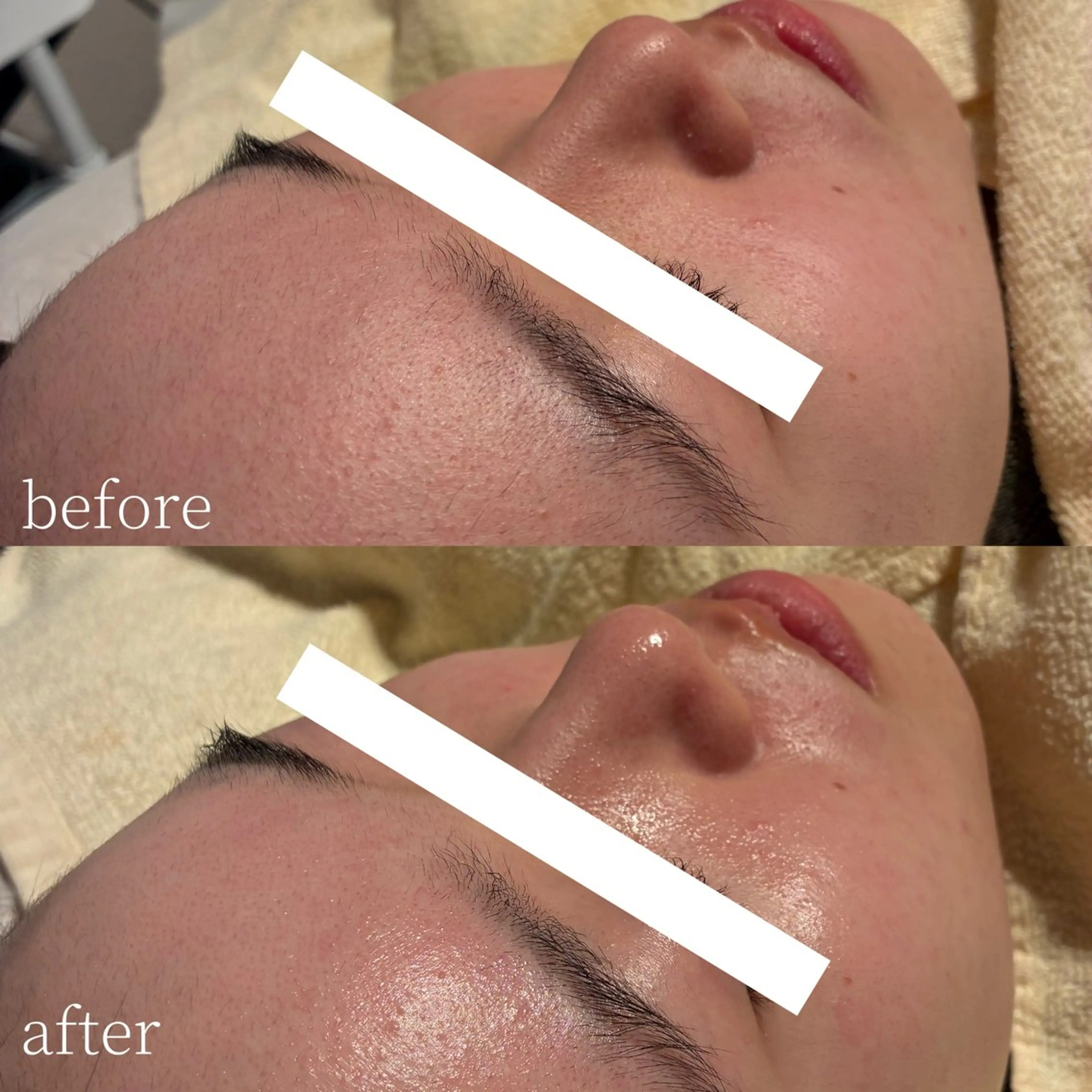 脱毛 Erika komorebi_のエステ・リラクイメージ