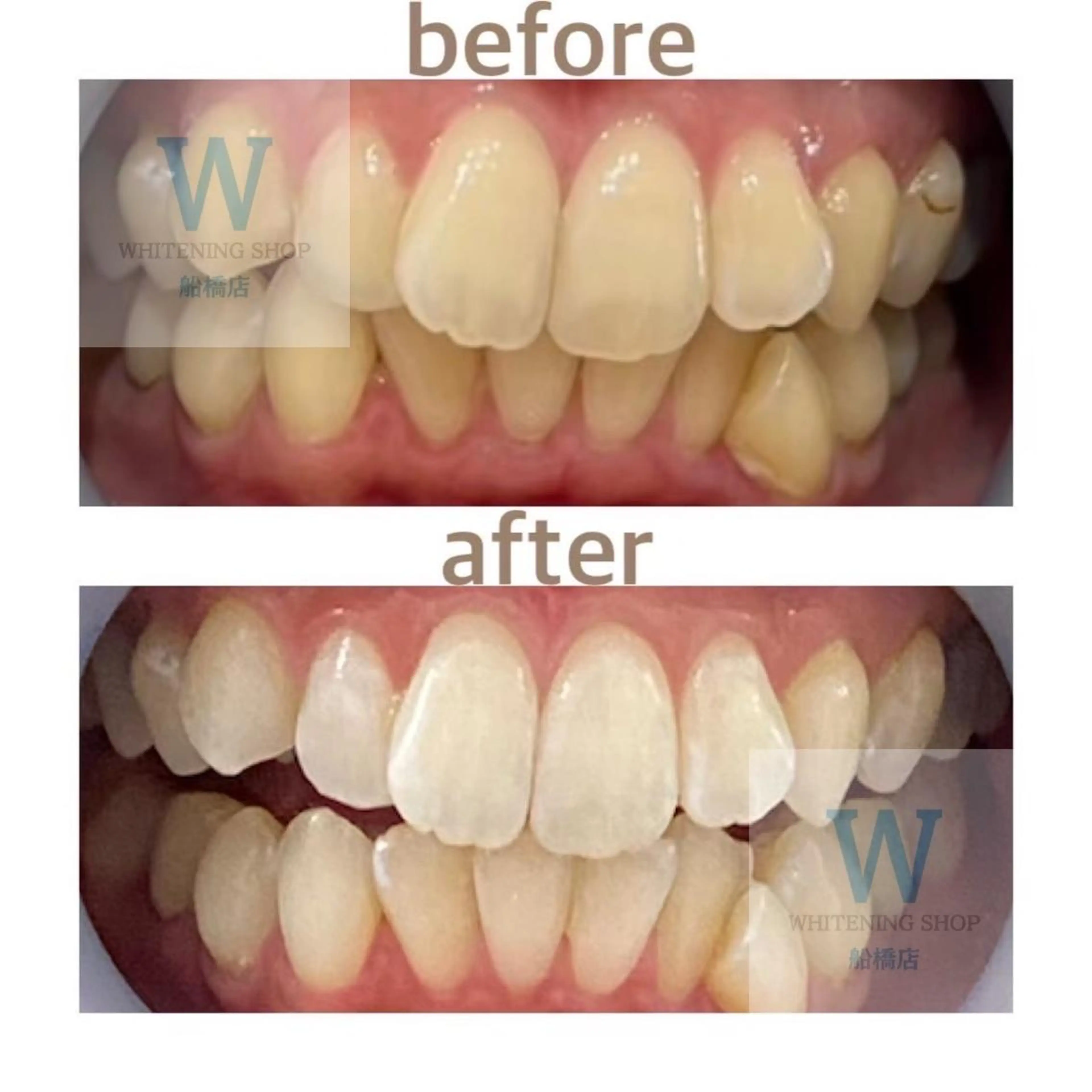 エステ リラク ホワイトニング ショップ船橋店🦷のエステ・リラクイメージ