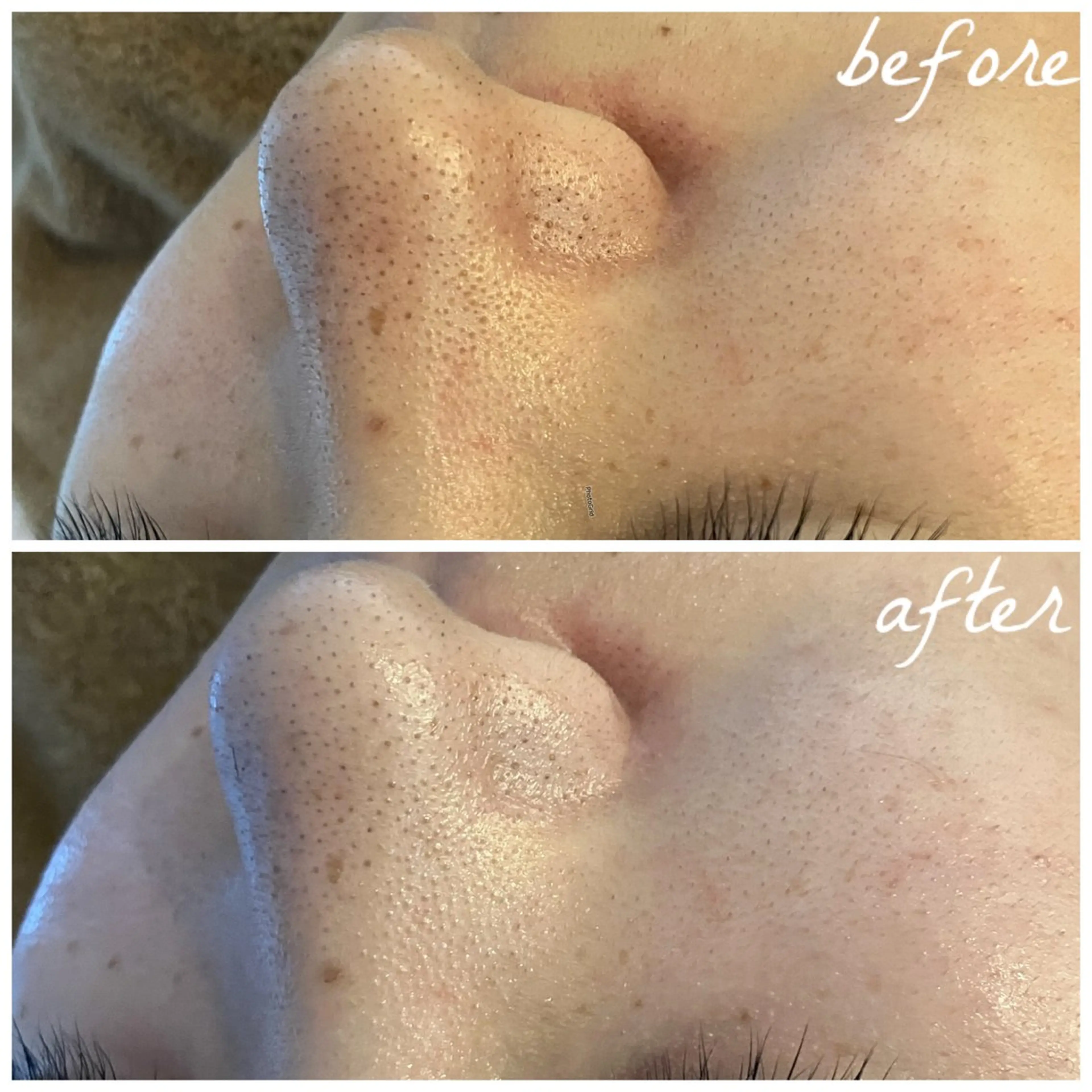 メンズ エステ メナード岐阜茜部 杉浦のエステ・リラクイメージ