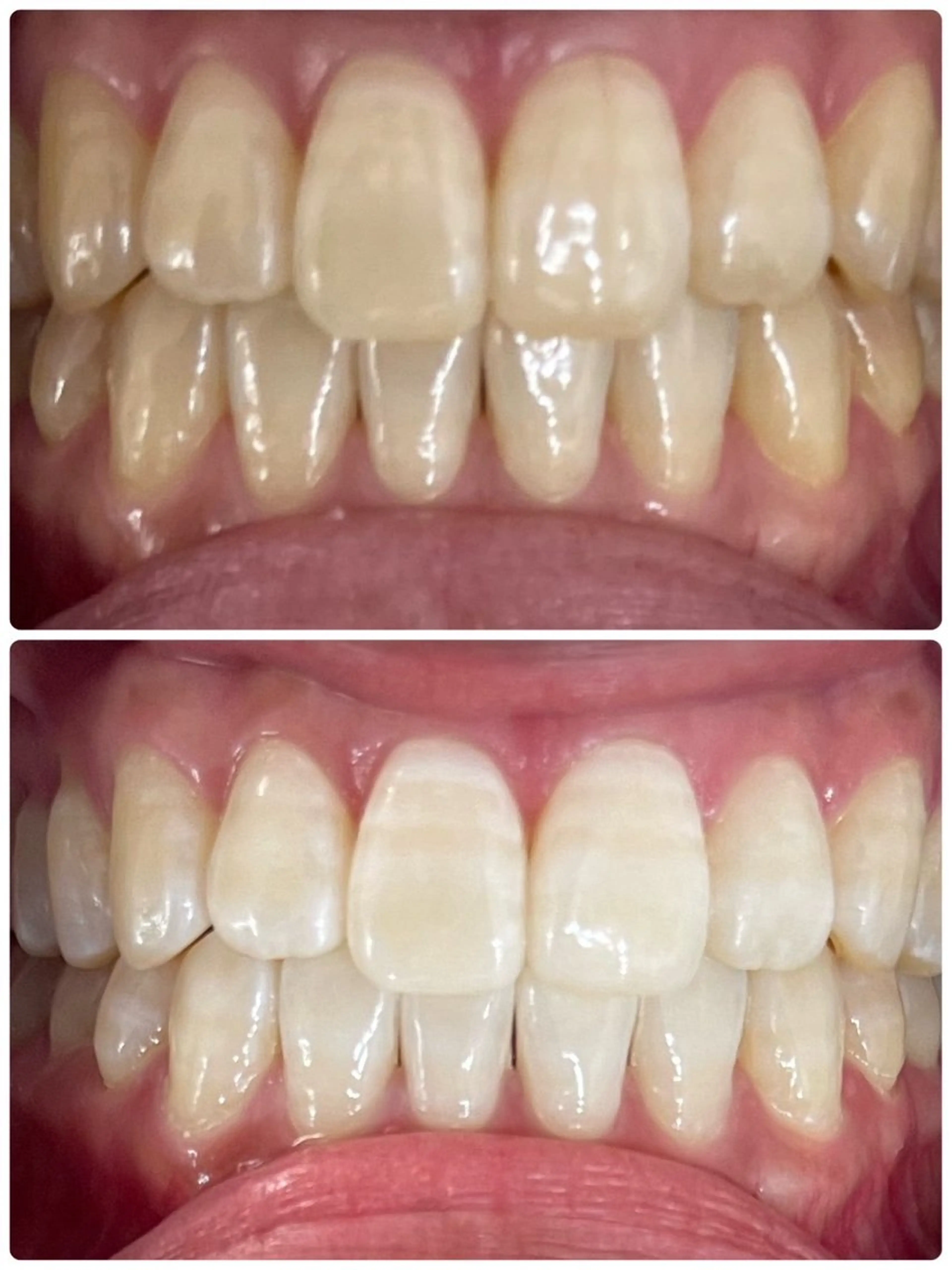 セルフホワイトニング エクシア徳島店マユのその他イメージ