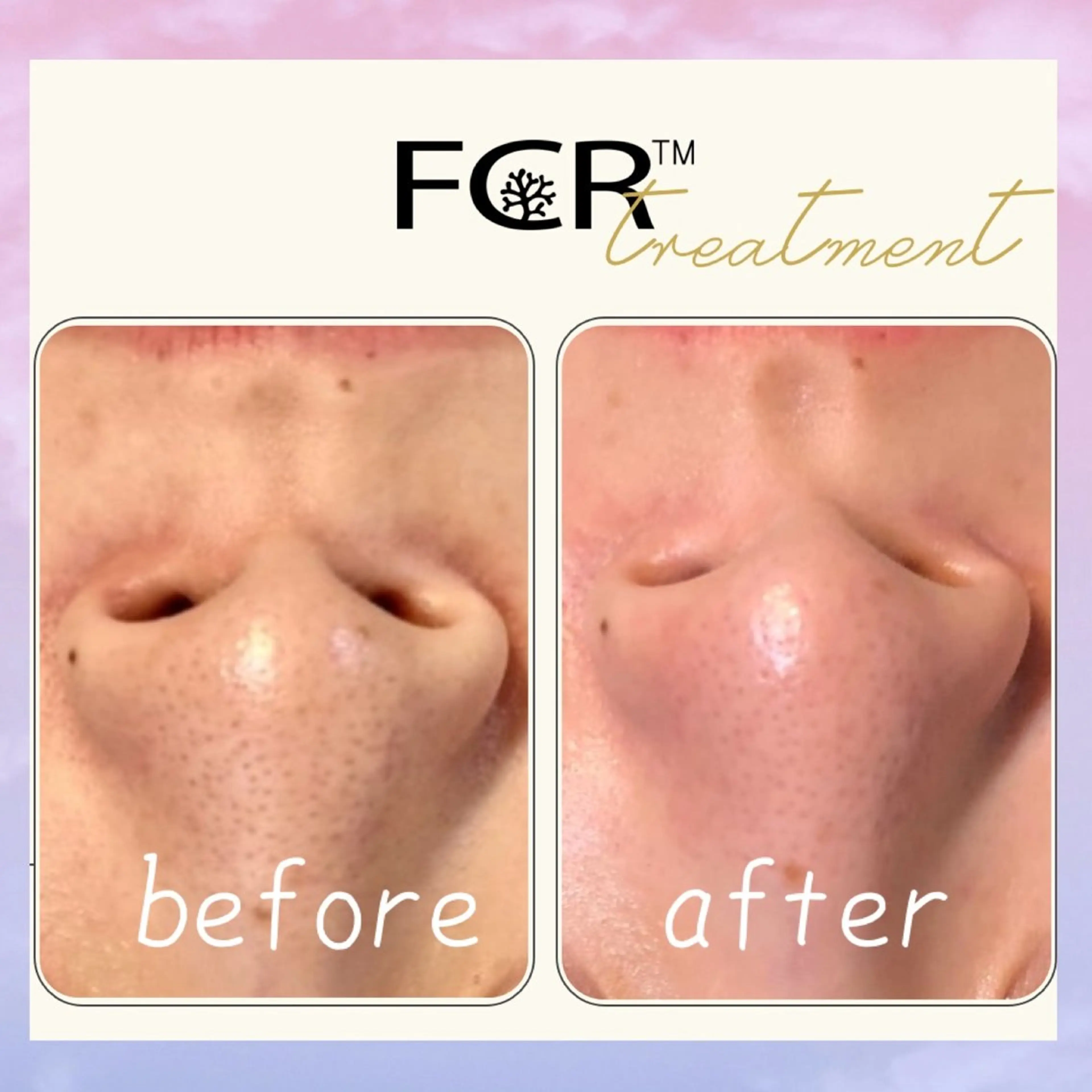 肌質改善Charme coco  増毛のエステ・リラクイメージ