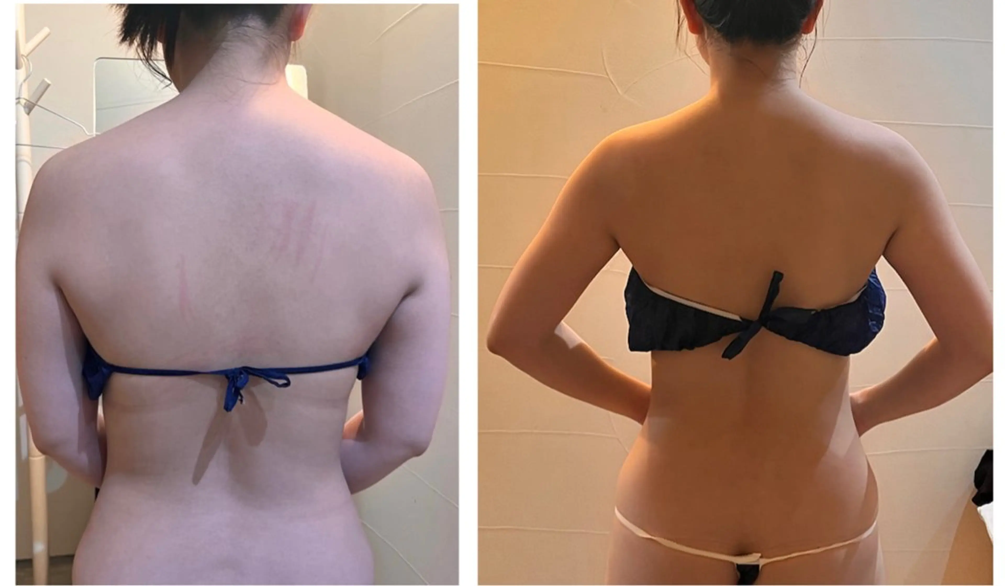 エステ 温活beautyサロンNeroli所属・切らない脂肪吸引🔥 Neroliまりこのエステ・リラクイメージ