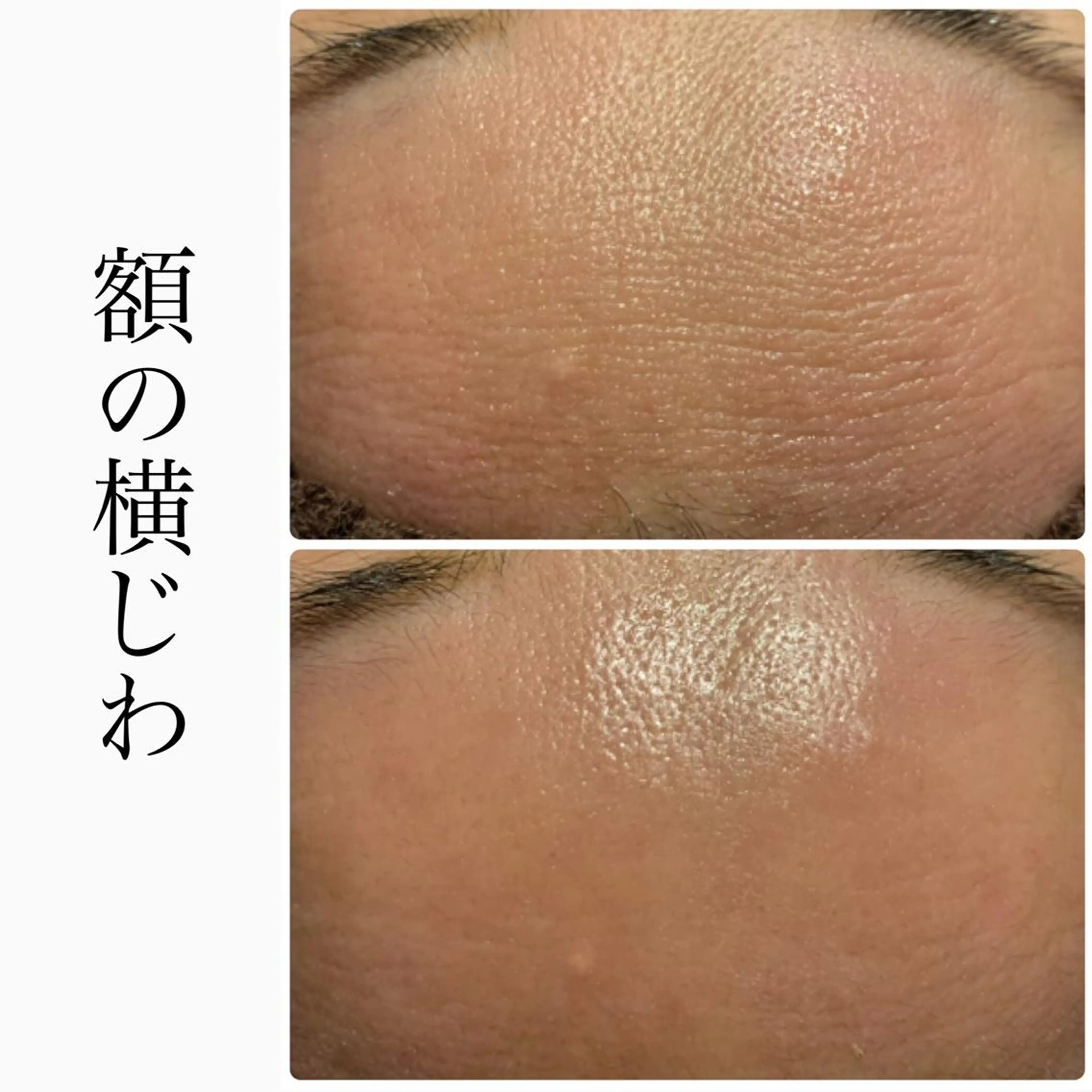 BeSkin藤沢店所属・ニキビ/肌質改善 BeSkin 藤沢店のエステ・リラクイメージ