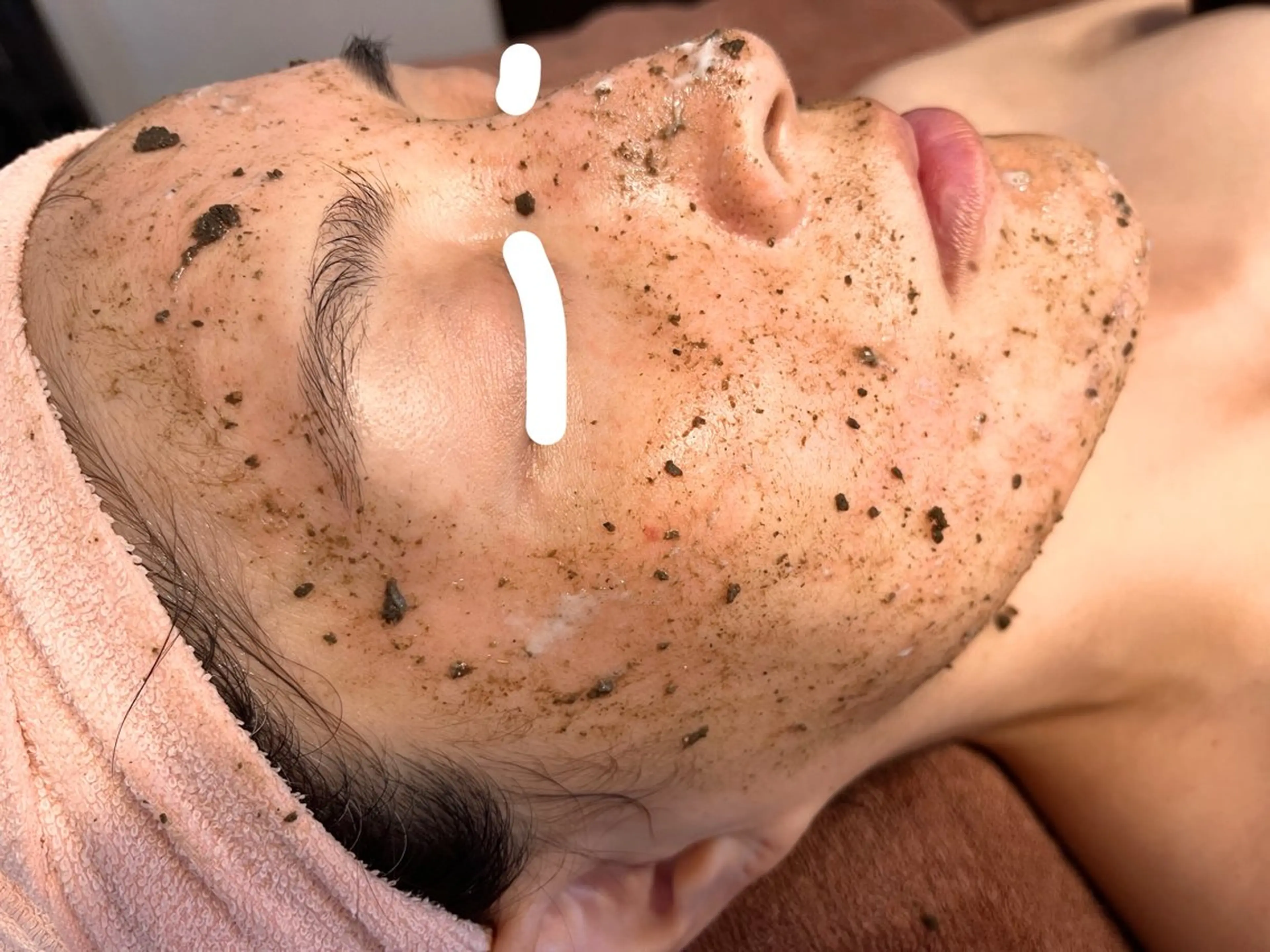 リセットハーブピーリングフェイシャル100分の写真