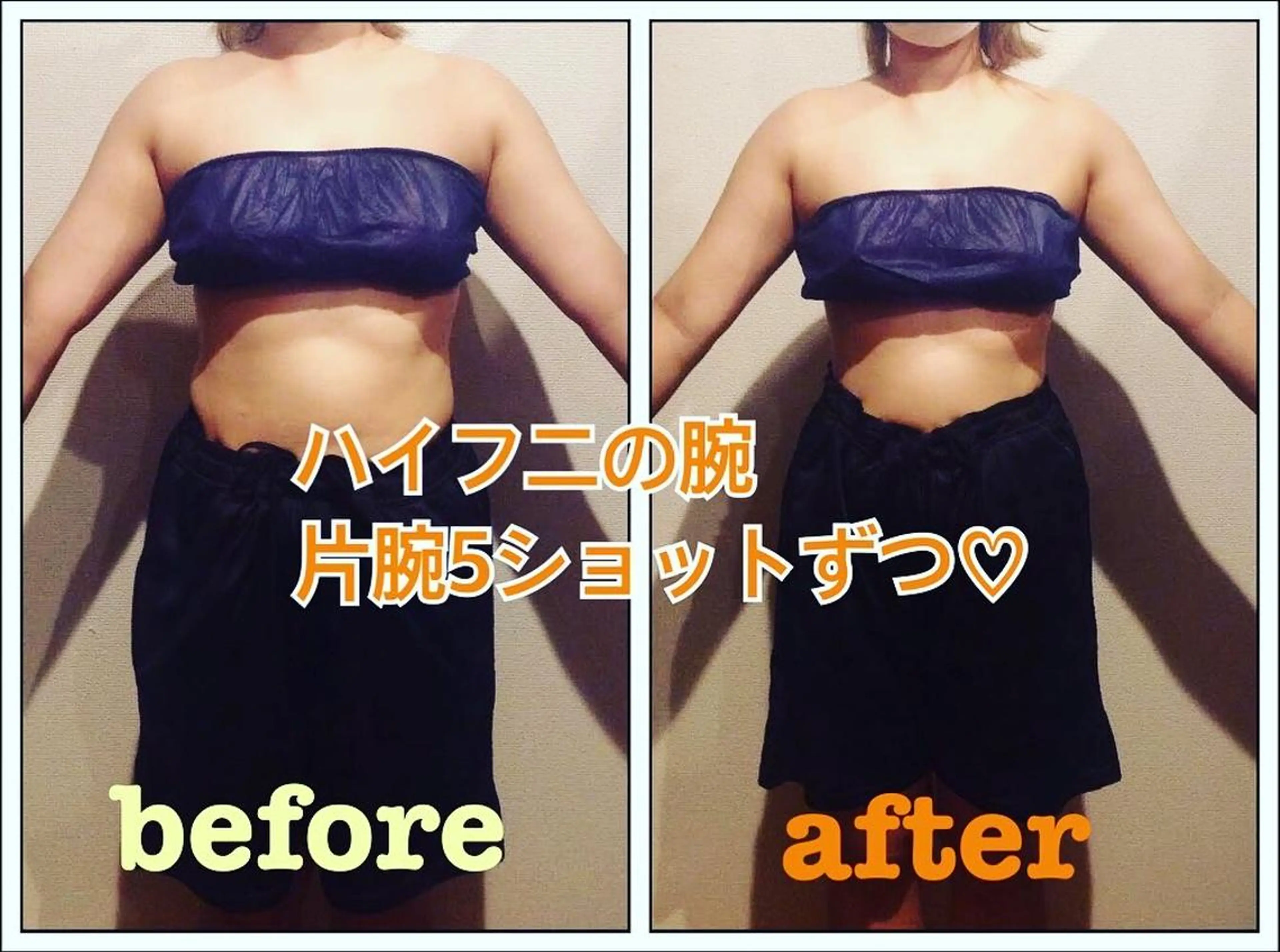 骨盤ダイエット痩身エステサロンBloom所属・坂田 真紀のエステ・リラクイメージ