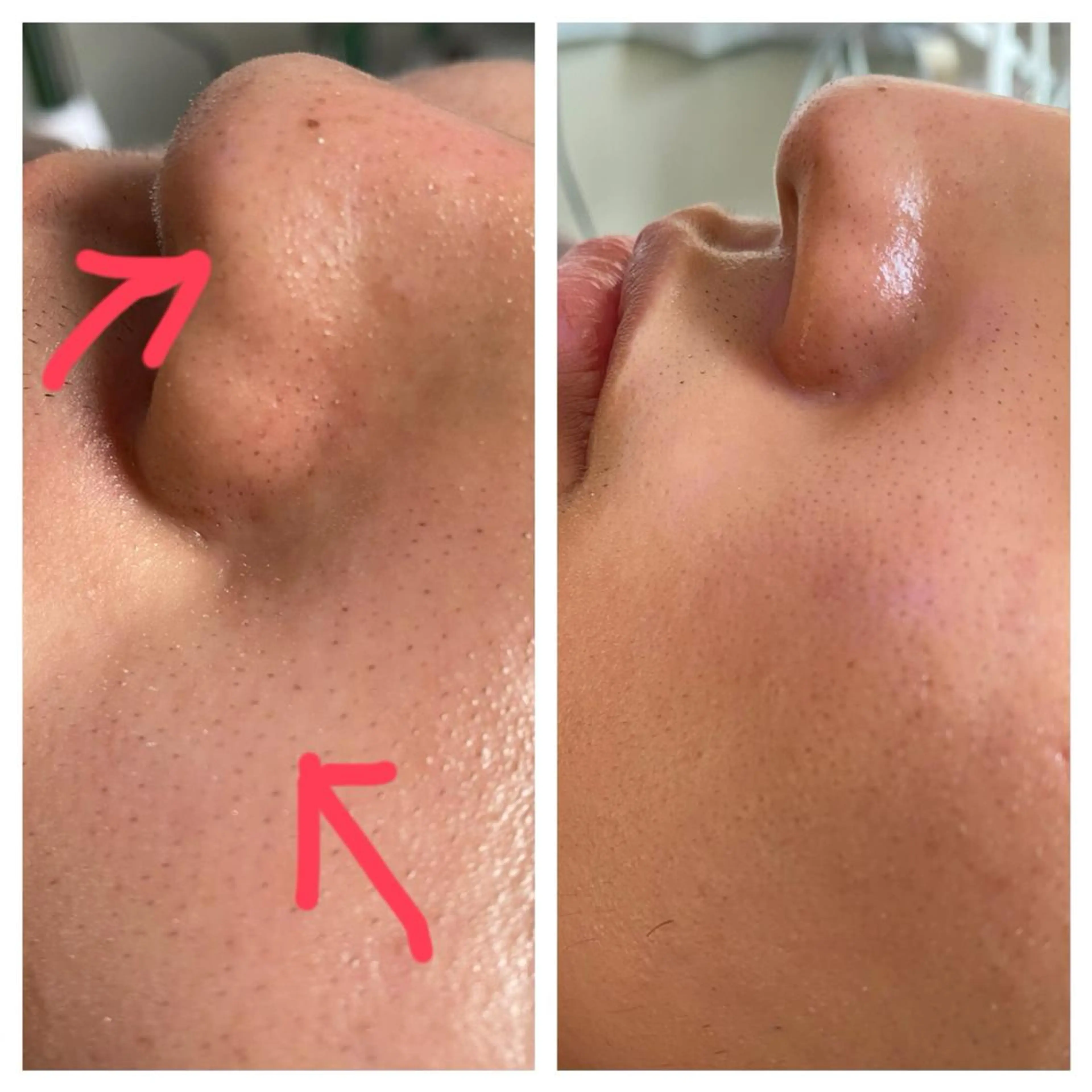 エステ 毛穴フェイシャル エステ専門店BBのエステ・リラクイメージ