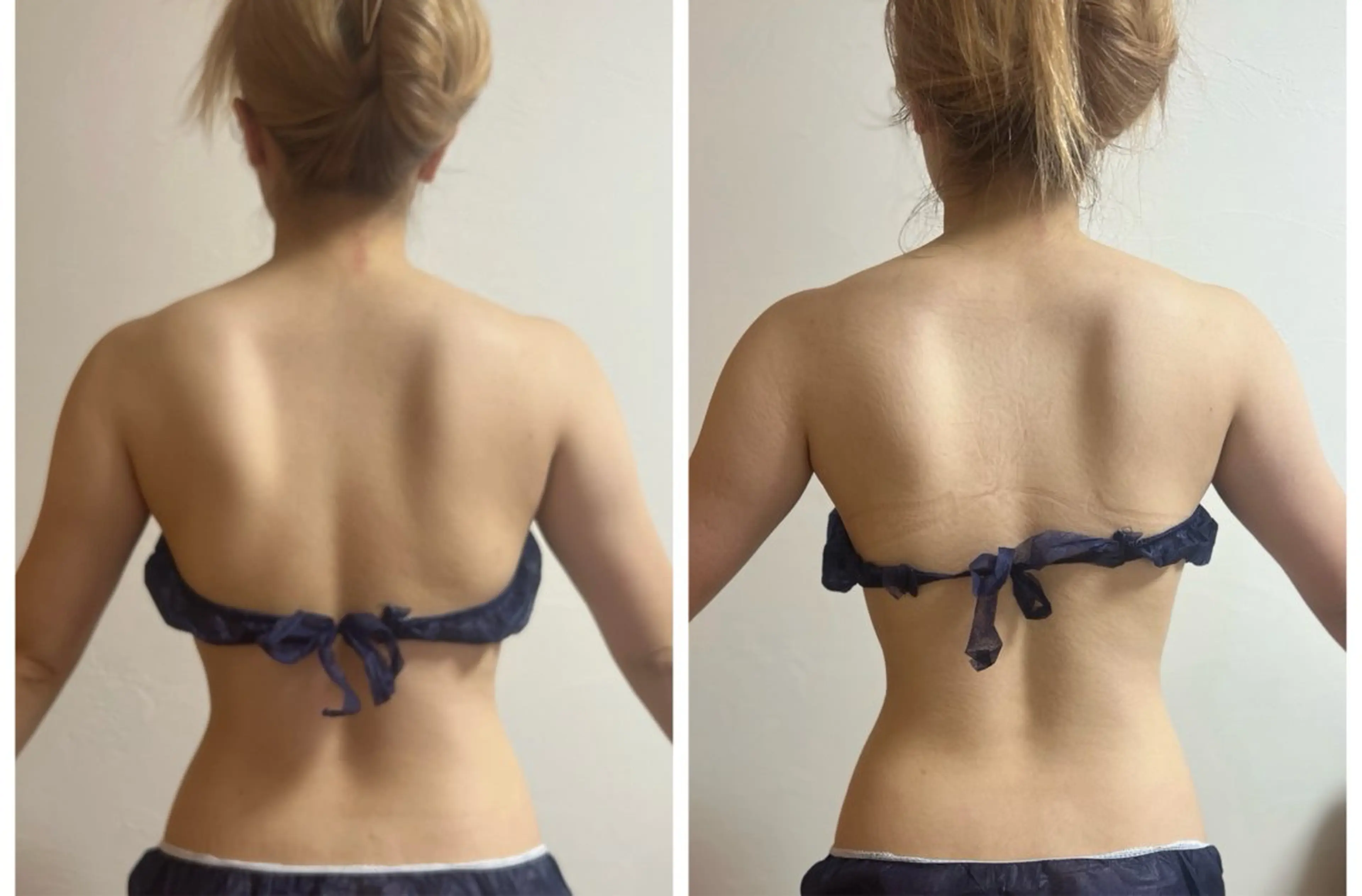 【初回限定】⭐︎お試し全身⭐︎痩身全身EMS ・キャビ・超音波＋リンパマッサージ＋遠赤外線マット発汗　90分コースの写真