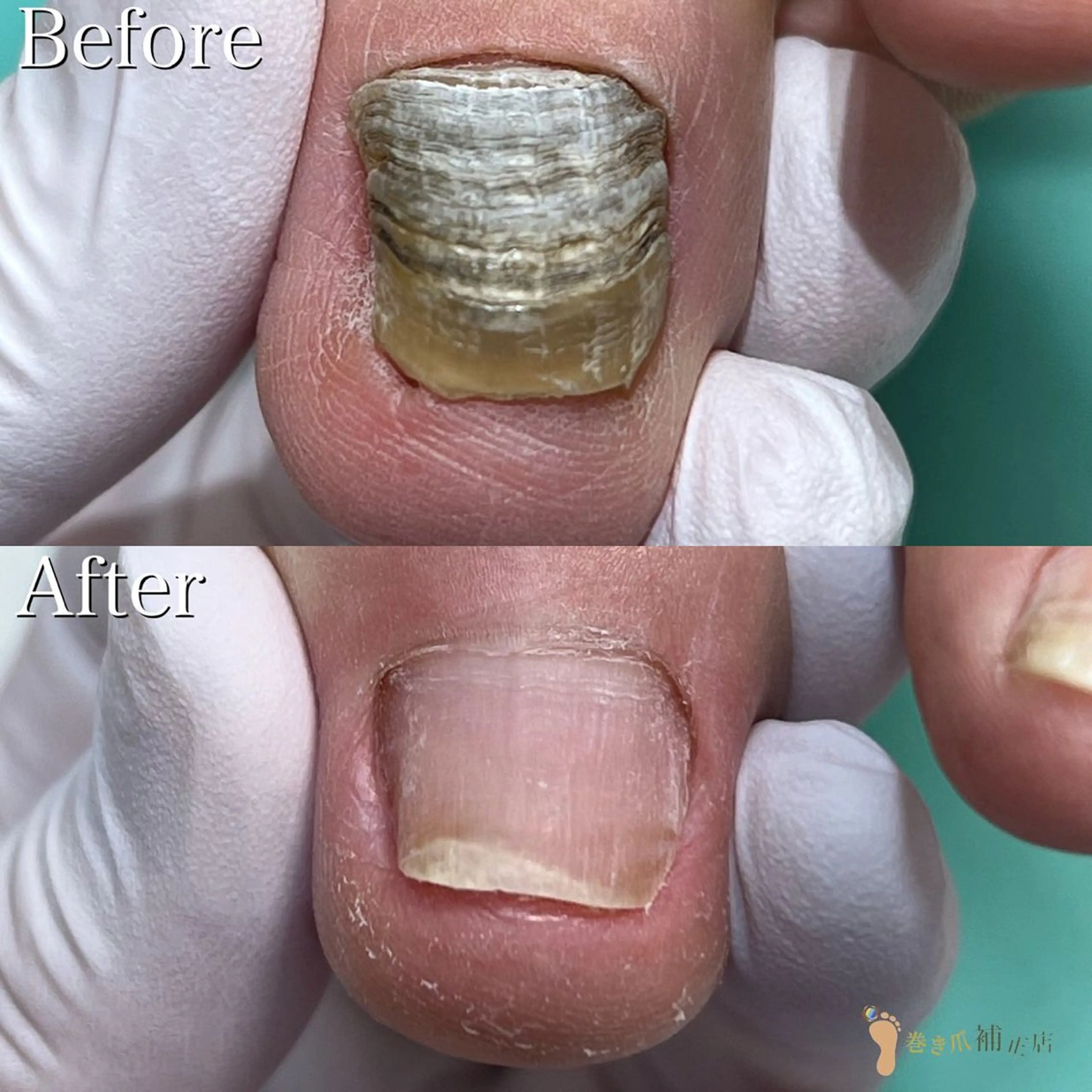 ネイル 大宮巻き爪補正店所属・大宮 巻き爪補正店のエステ・リラクイメージ