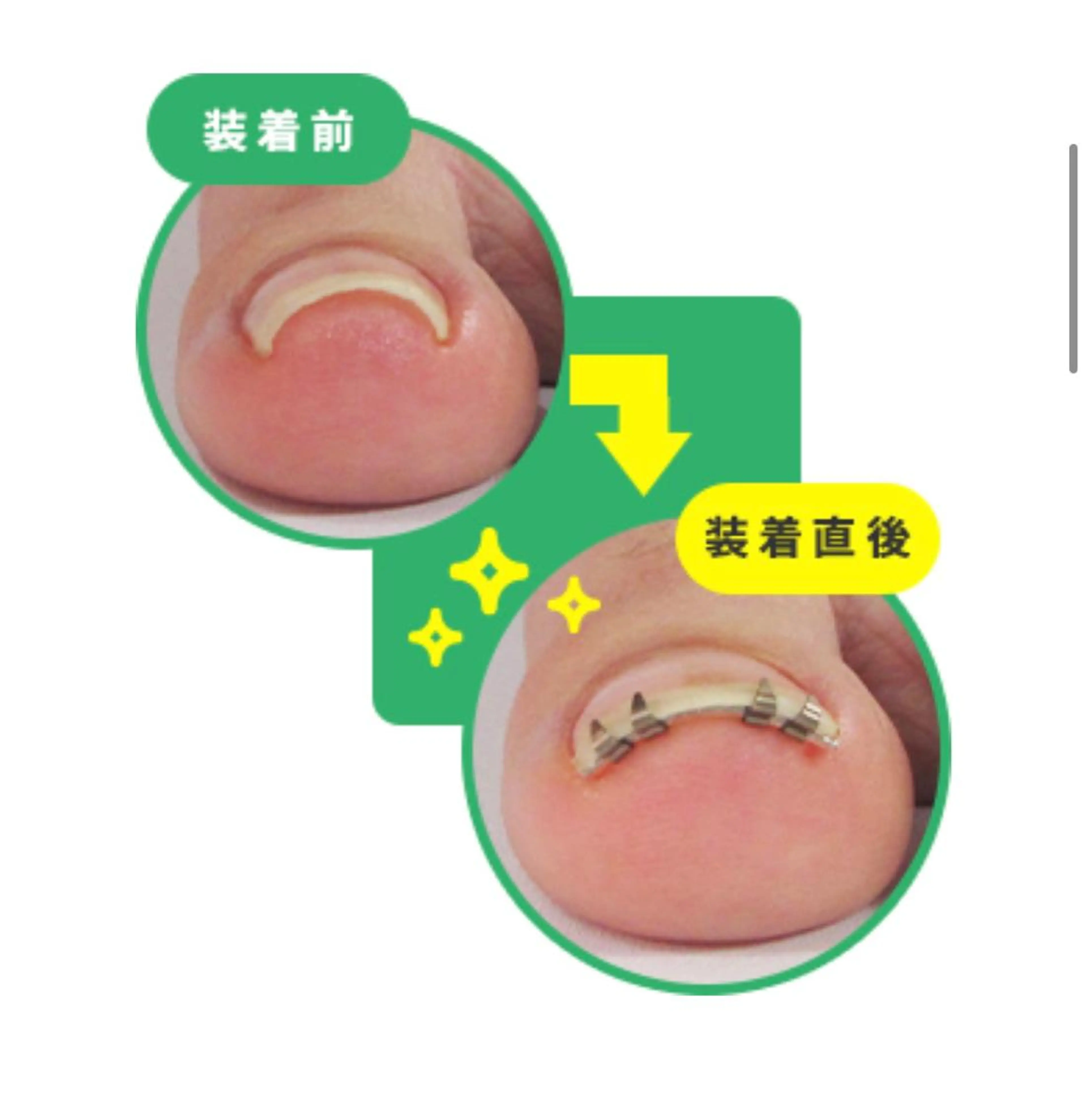 フットネイル Genie Nailsのネイルデザイン