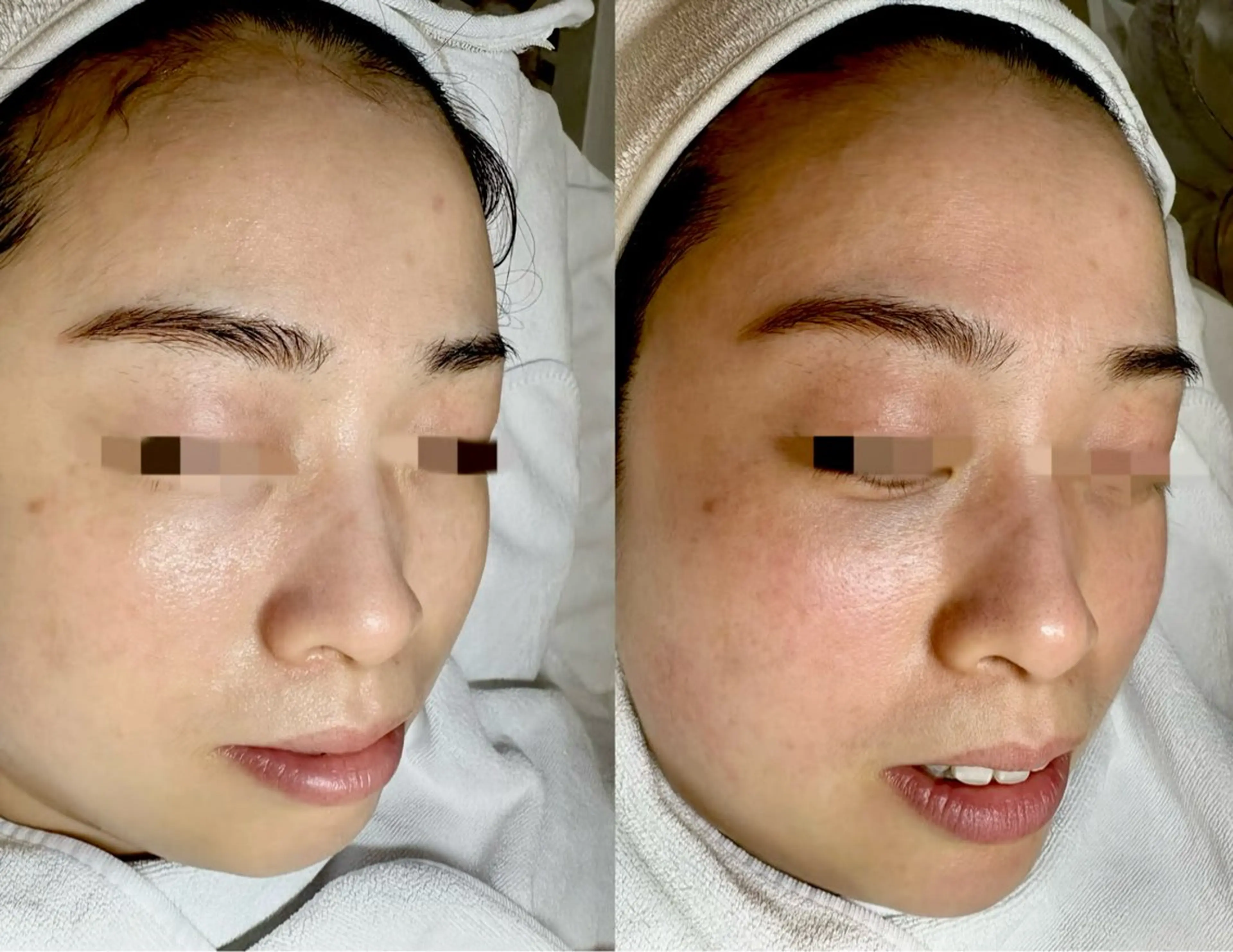 MONICAビューティサロン所属・MONICAサロン ⭐︎フェイシャル痩身のエステ・リラクイメージ