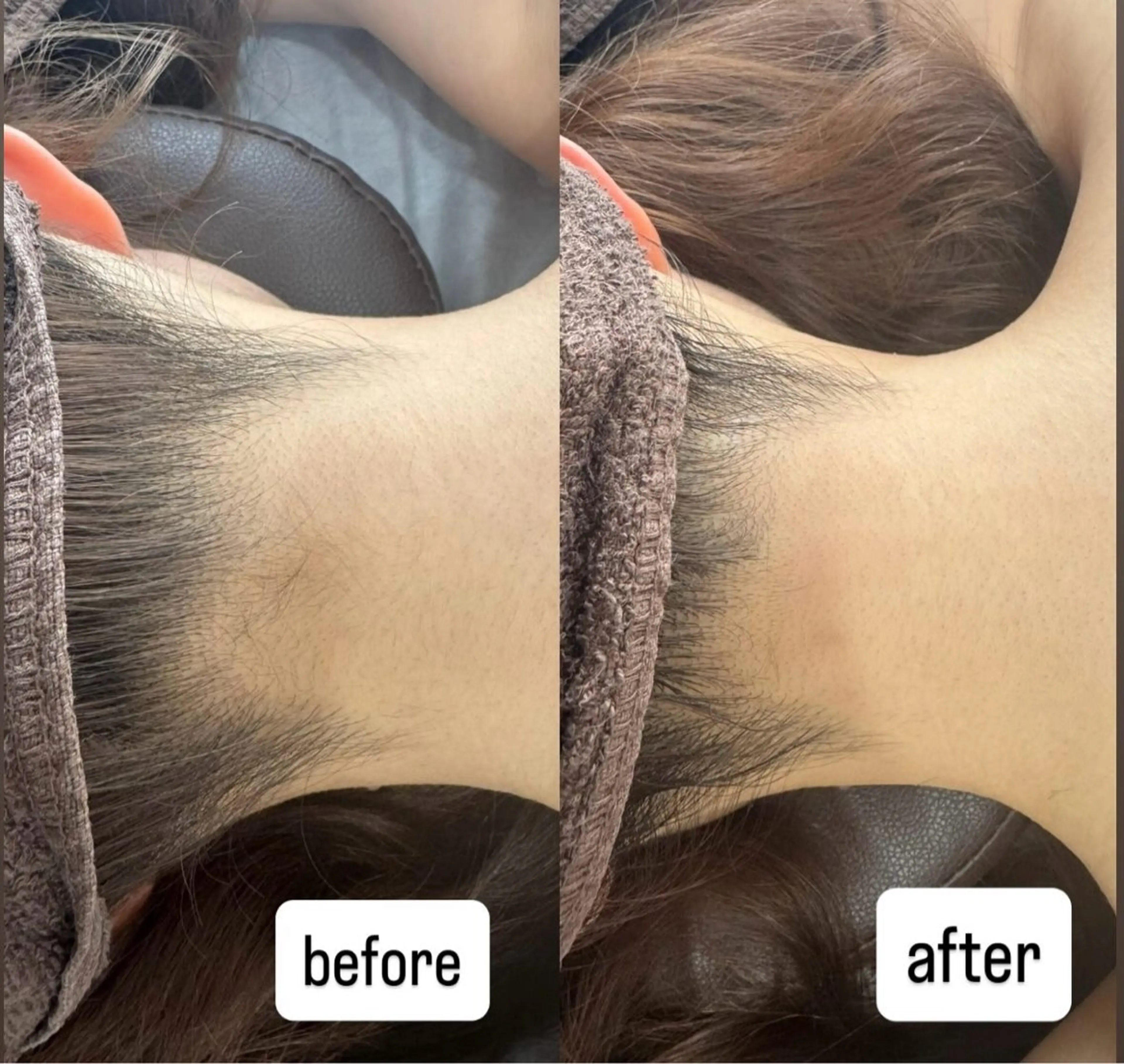 salonvilla所属・villa ☺︎草山 楓花のエステ・リラクイメージ