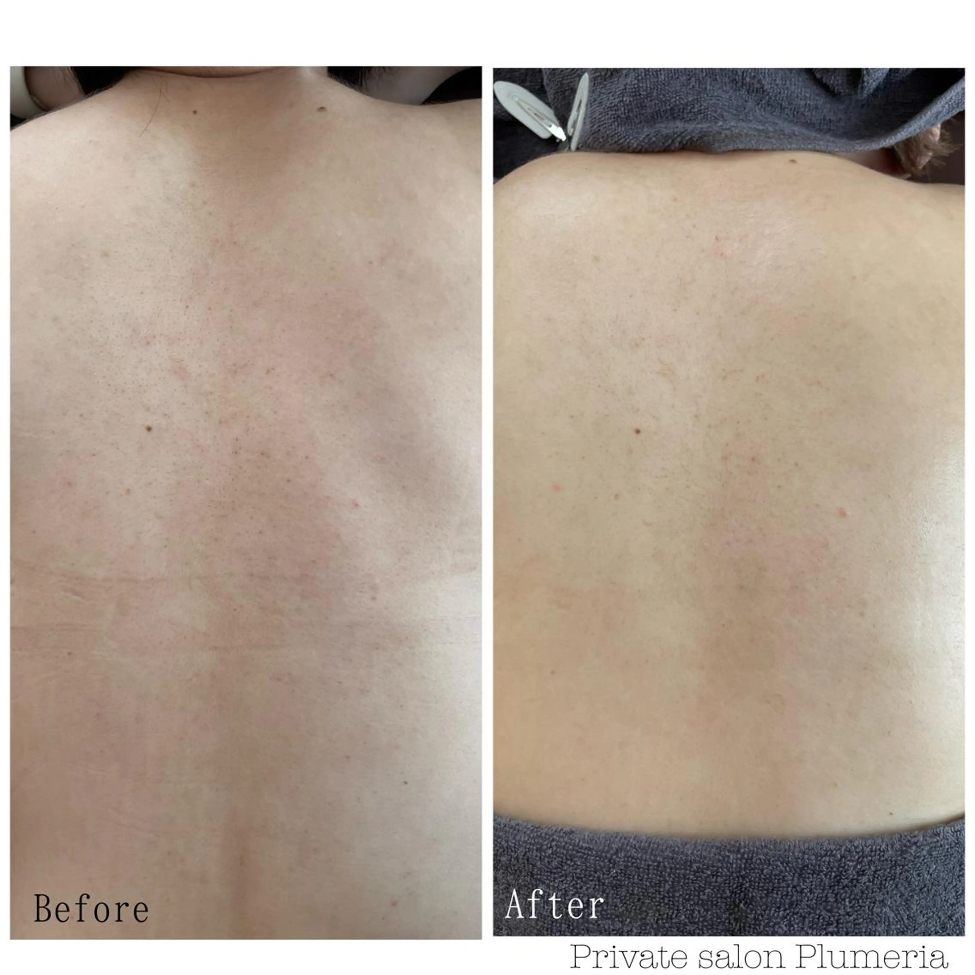 エステ リラク 川上 莉果のエステ・リラクイメージ