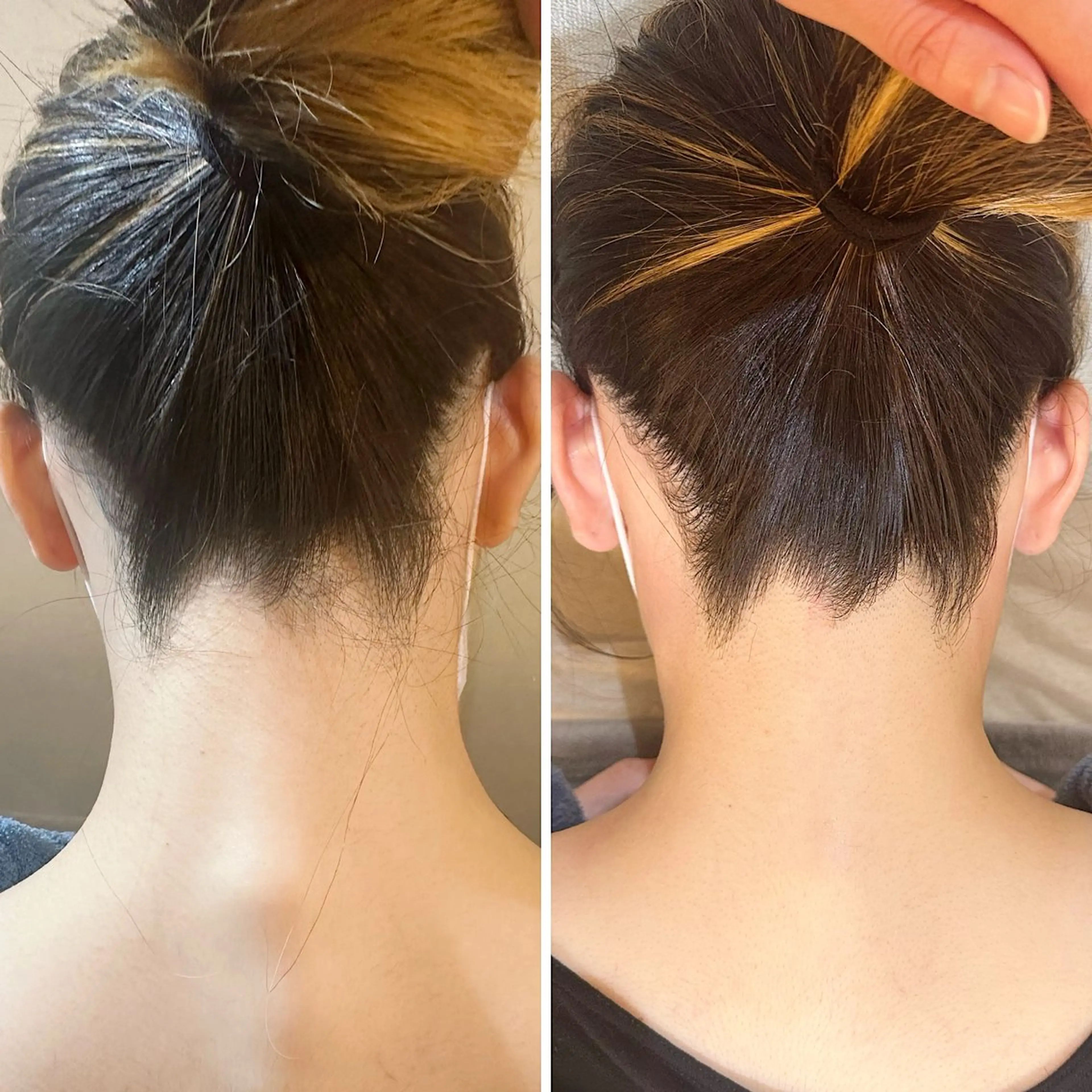 脱毛 うなじ脱毛/美肌脱毛 LABELのエステ・リラクイメージ