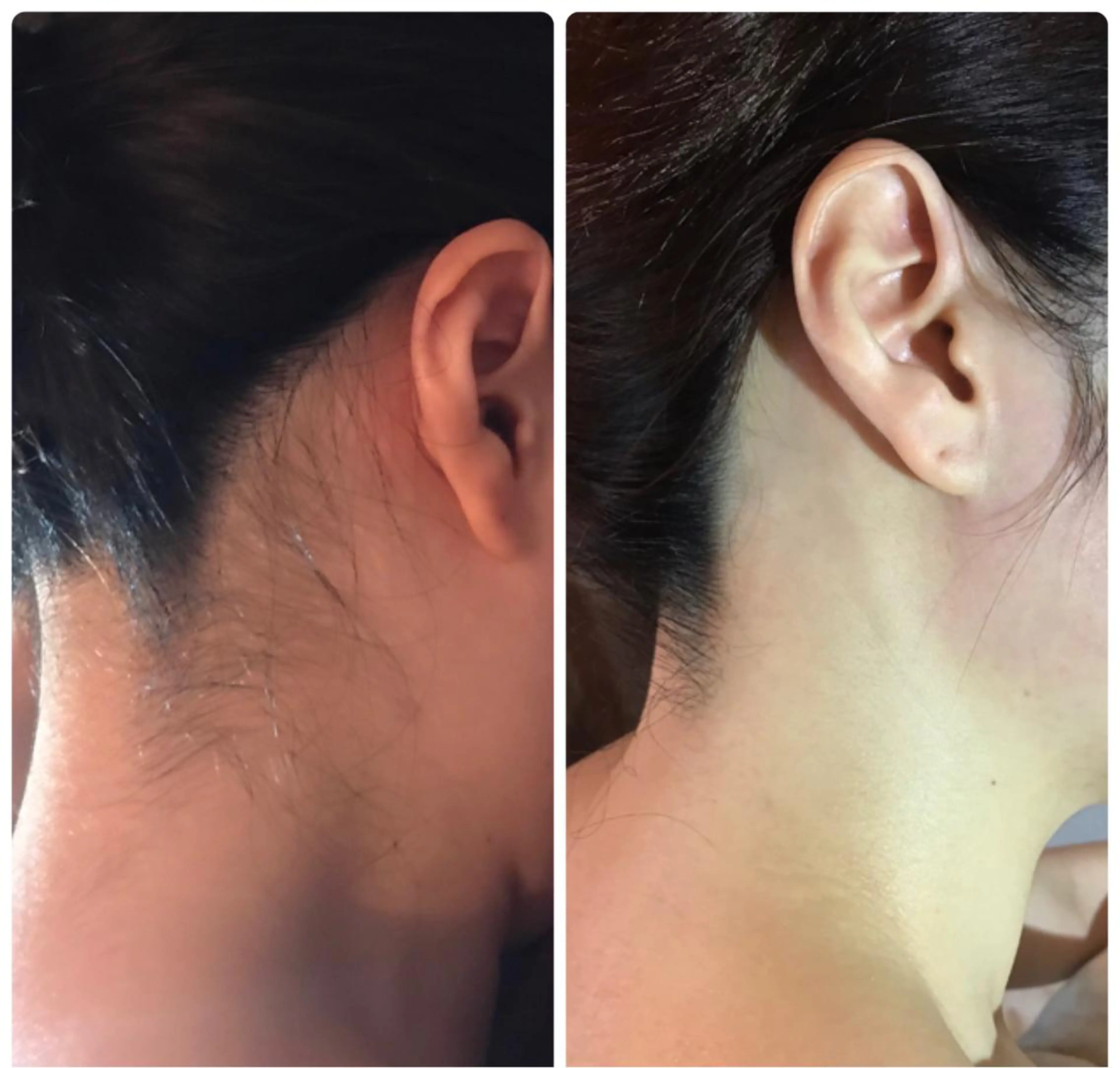 代表 MOMOのエステ・リラクイメージ