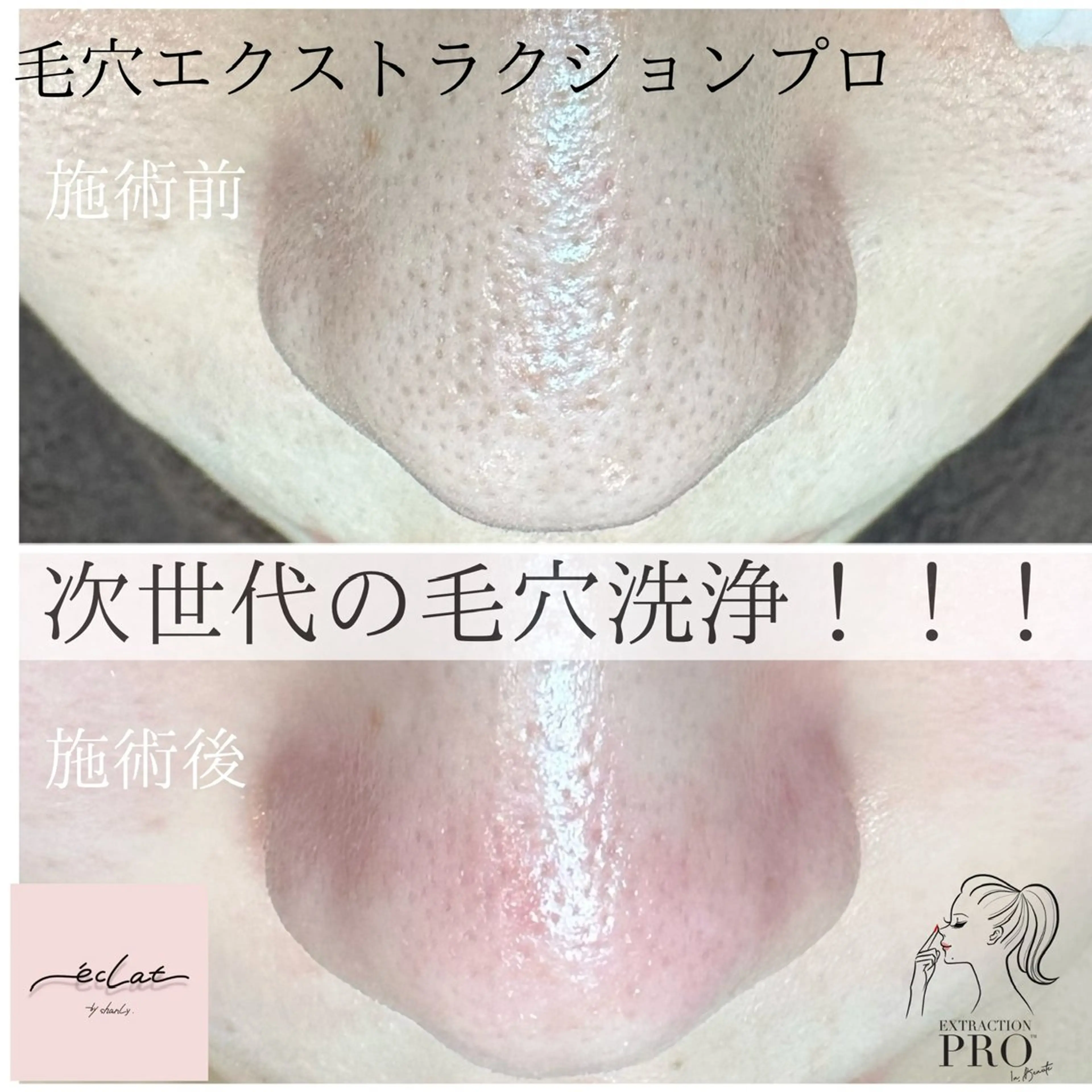 岩本 麻那のマツエク・マツパデザイン