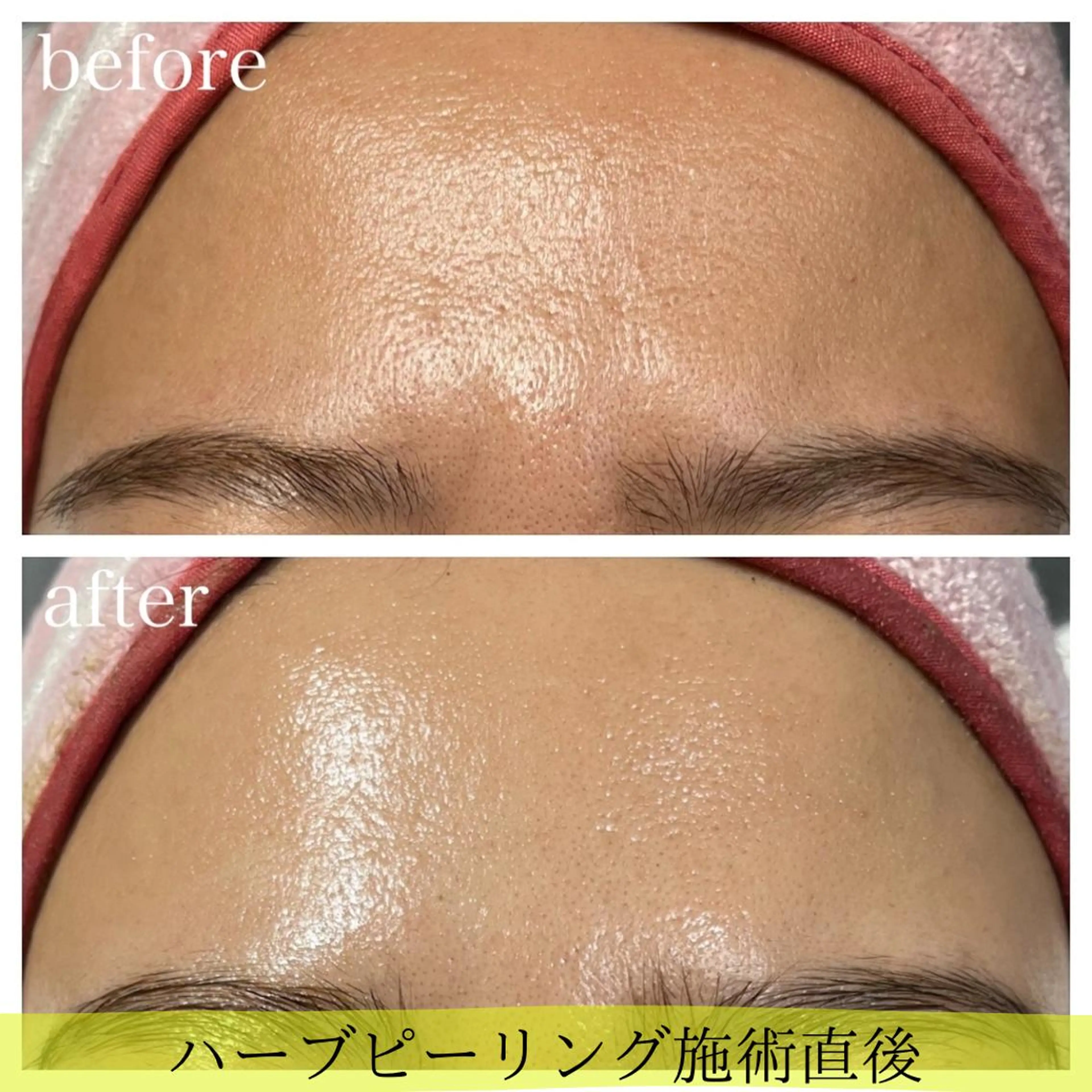 エステ kapua所属・Kapua🌺 マユのマツエク・マツパデザイン