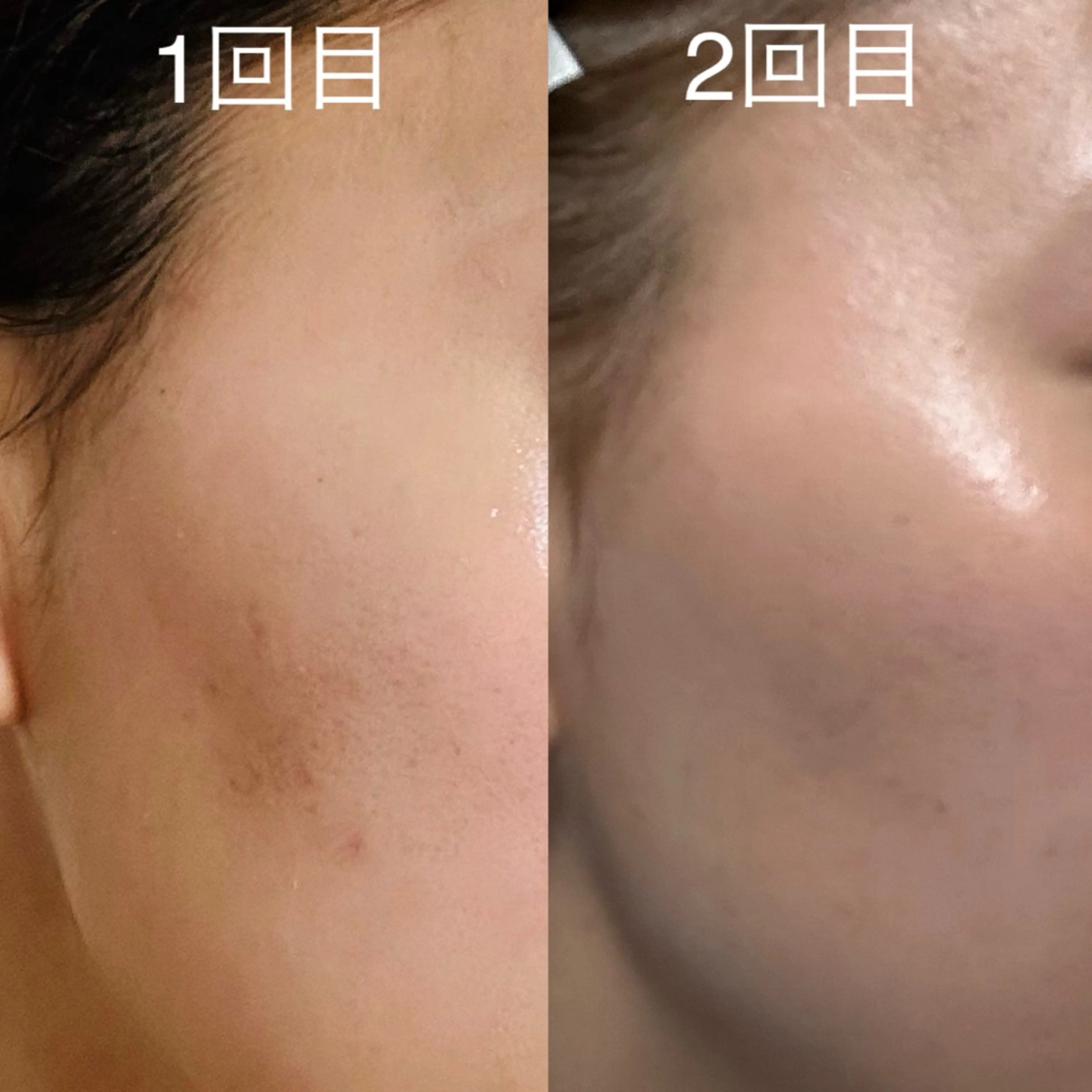 エステ リラク 【肌質改善サロン】 リーフィアのエステ・リラクイメージ