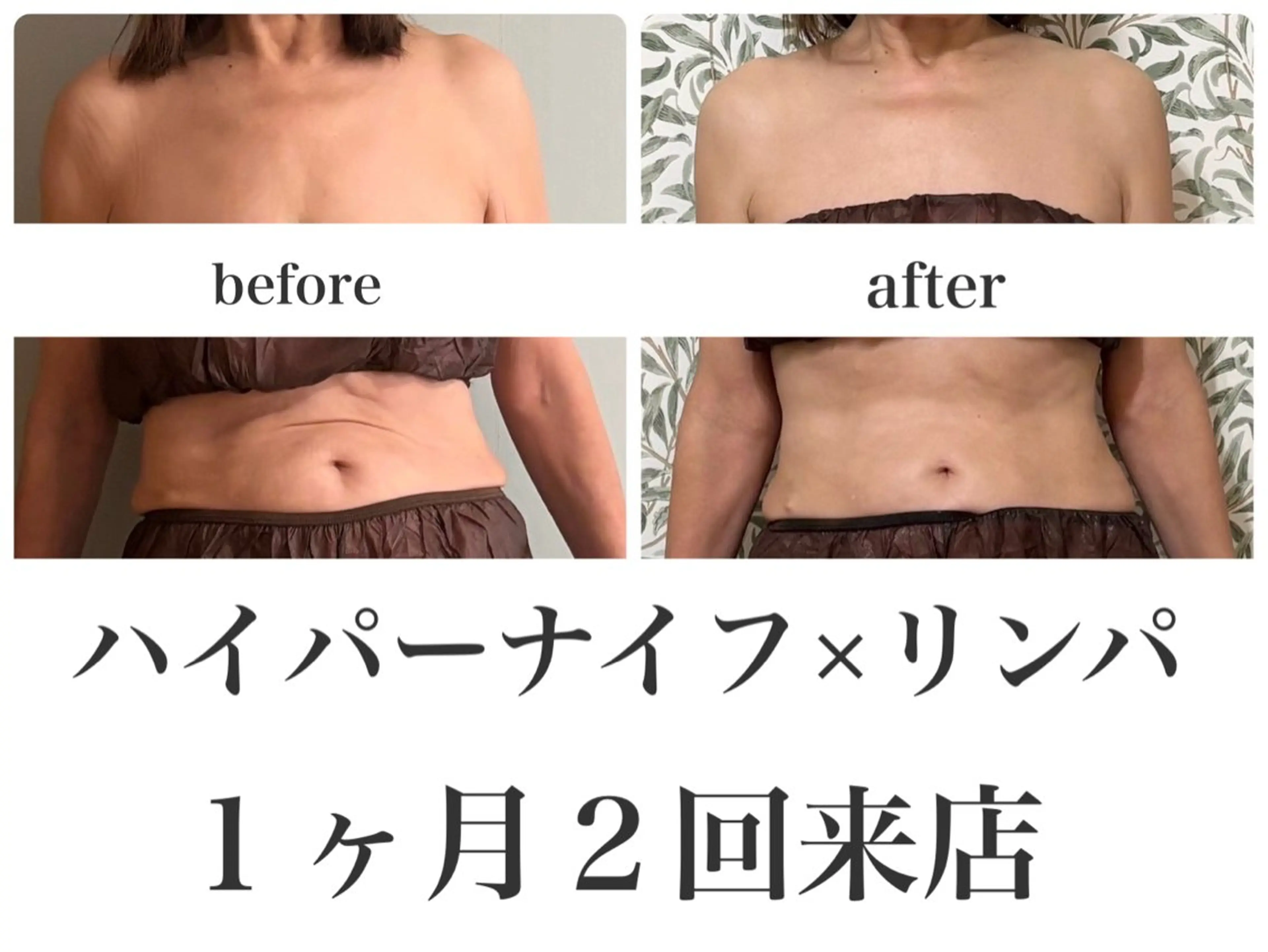 エステ REME/リミー エステサロン東大宮店所属・小林 雪乃のエステ・リラクイメージ