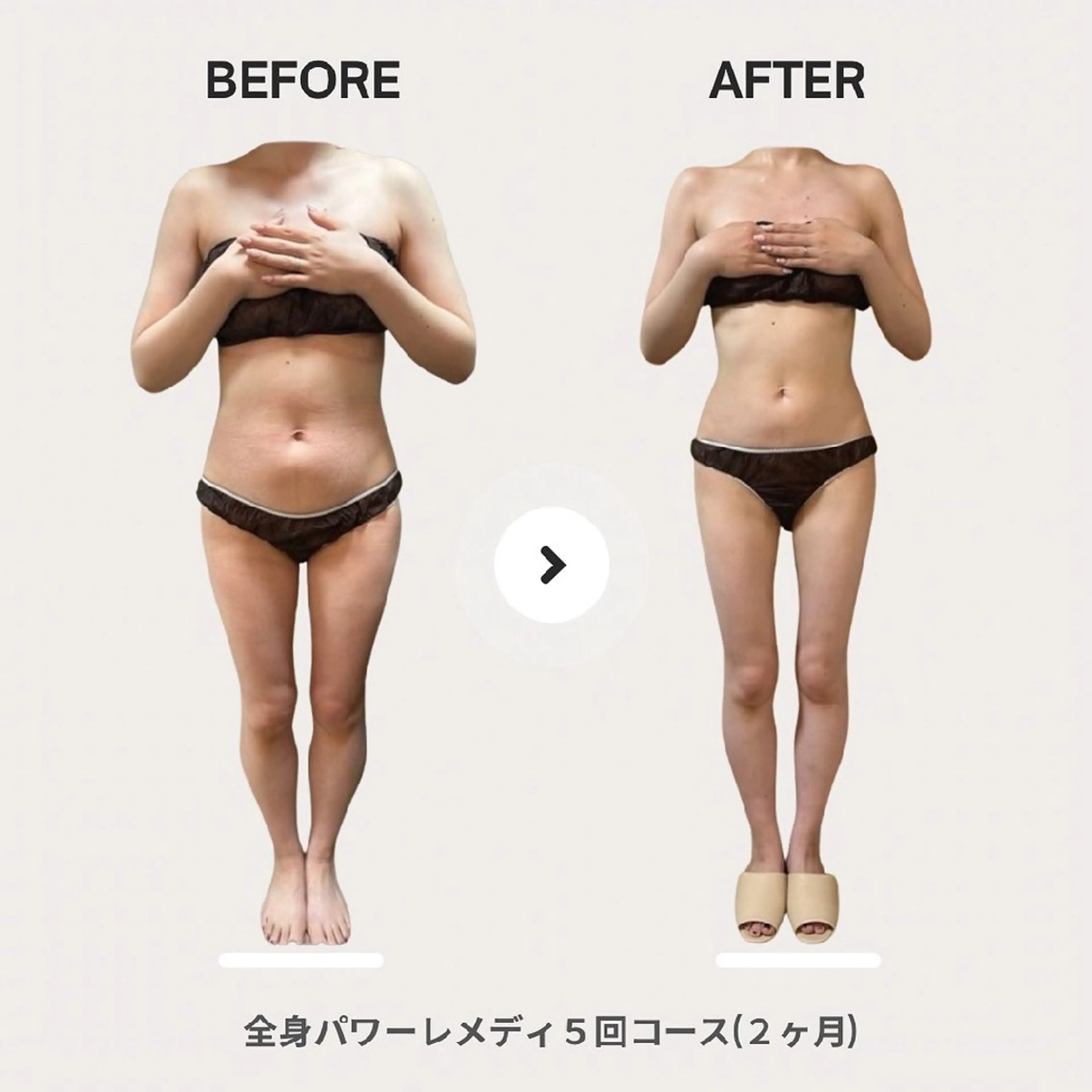 エステ リラク biloop所属・《痩身×疲労改善》 BILOOPのエステ・リラクイメージ