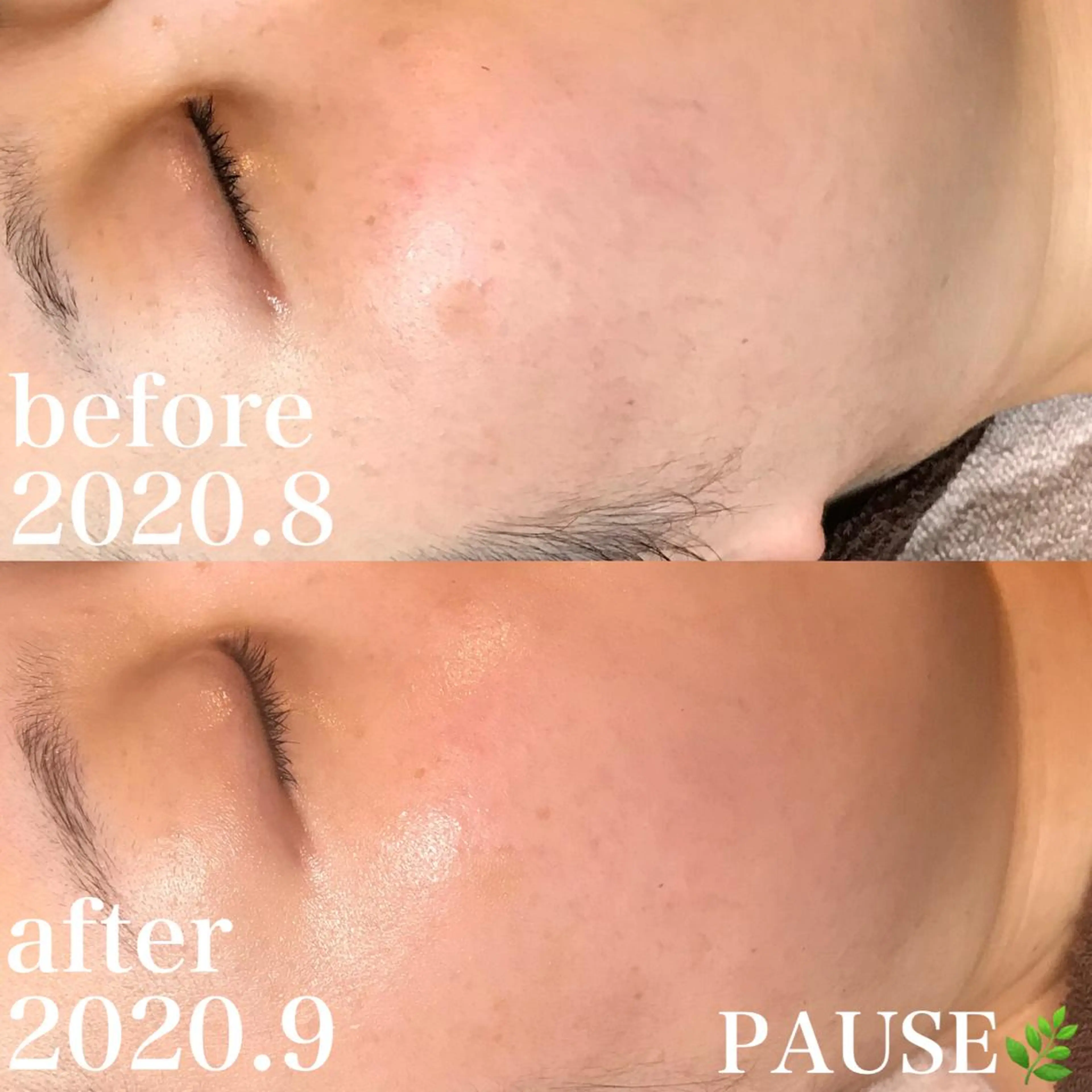 エステ 浜野 恵美のエステ・リラクイメージ