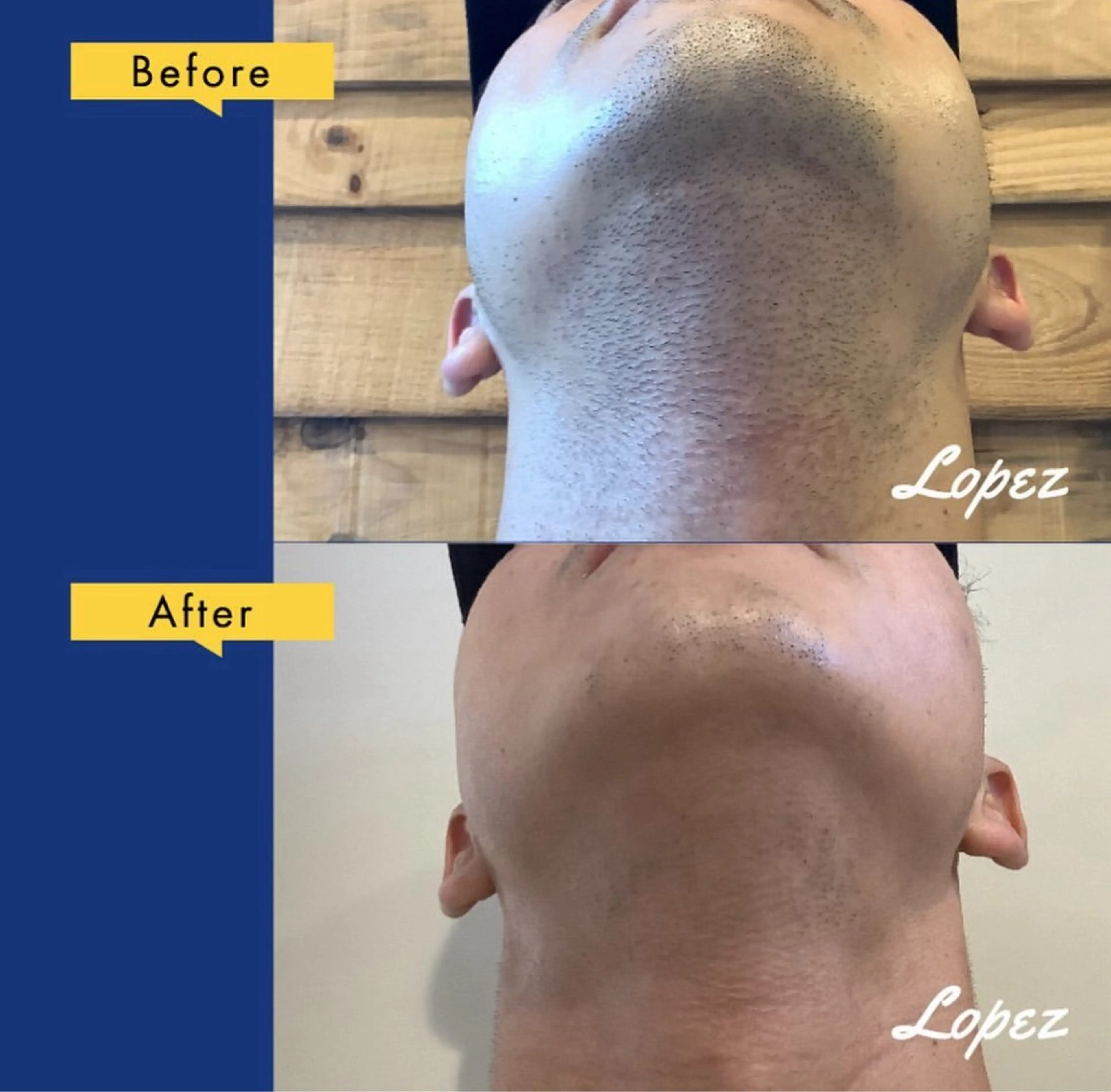 メンズ メンズ脱毛エステサロンロペス所属・小池 里穂のエステ・リラクイメージ