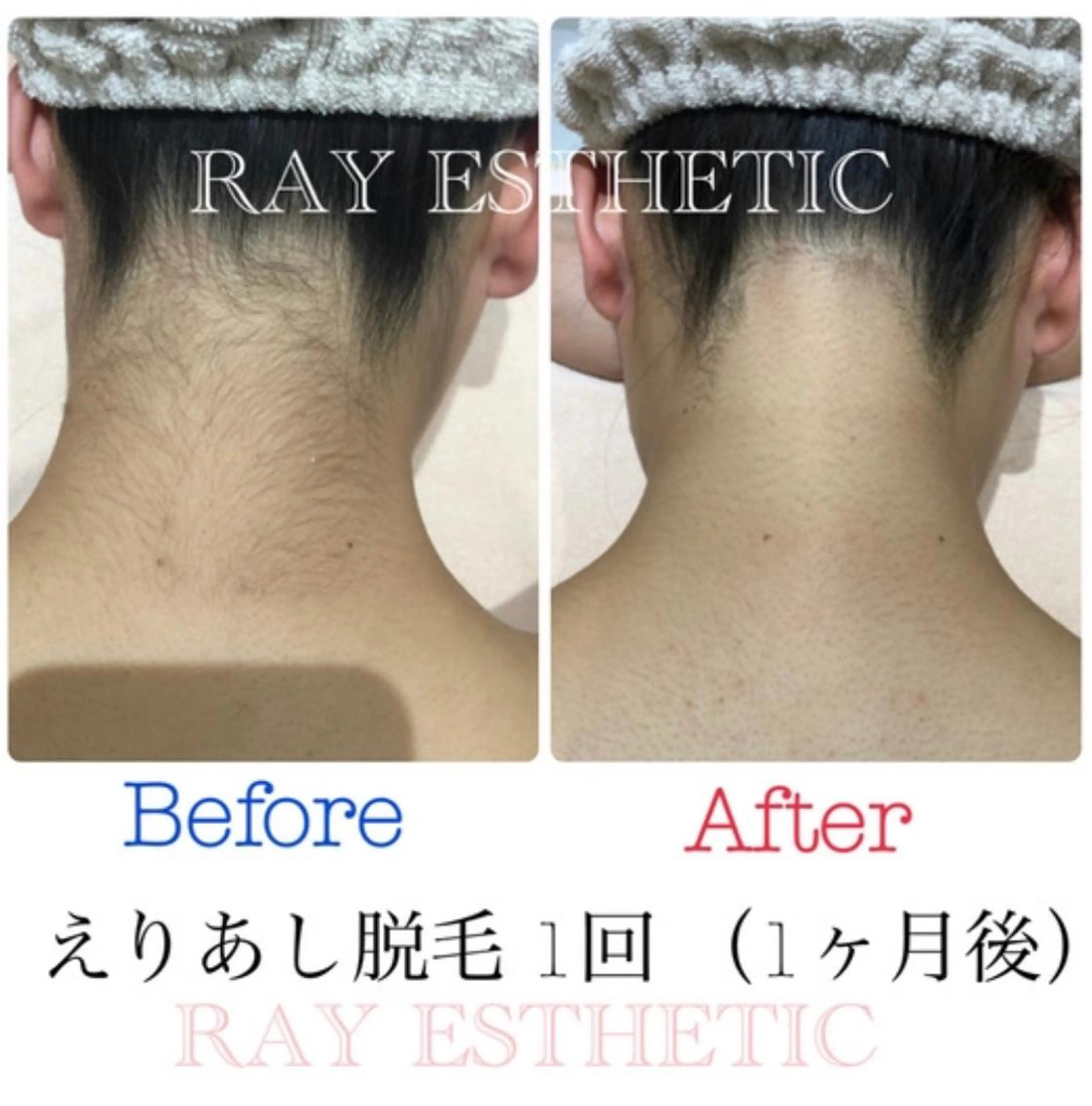 ネイル マツエク・マツパ レイフィールド江南店所属・レイエステティック 江南店のエステ・リラクイメージ