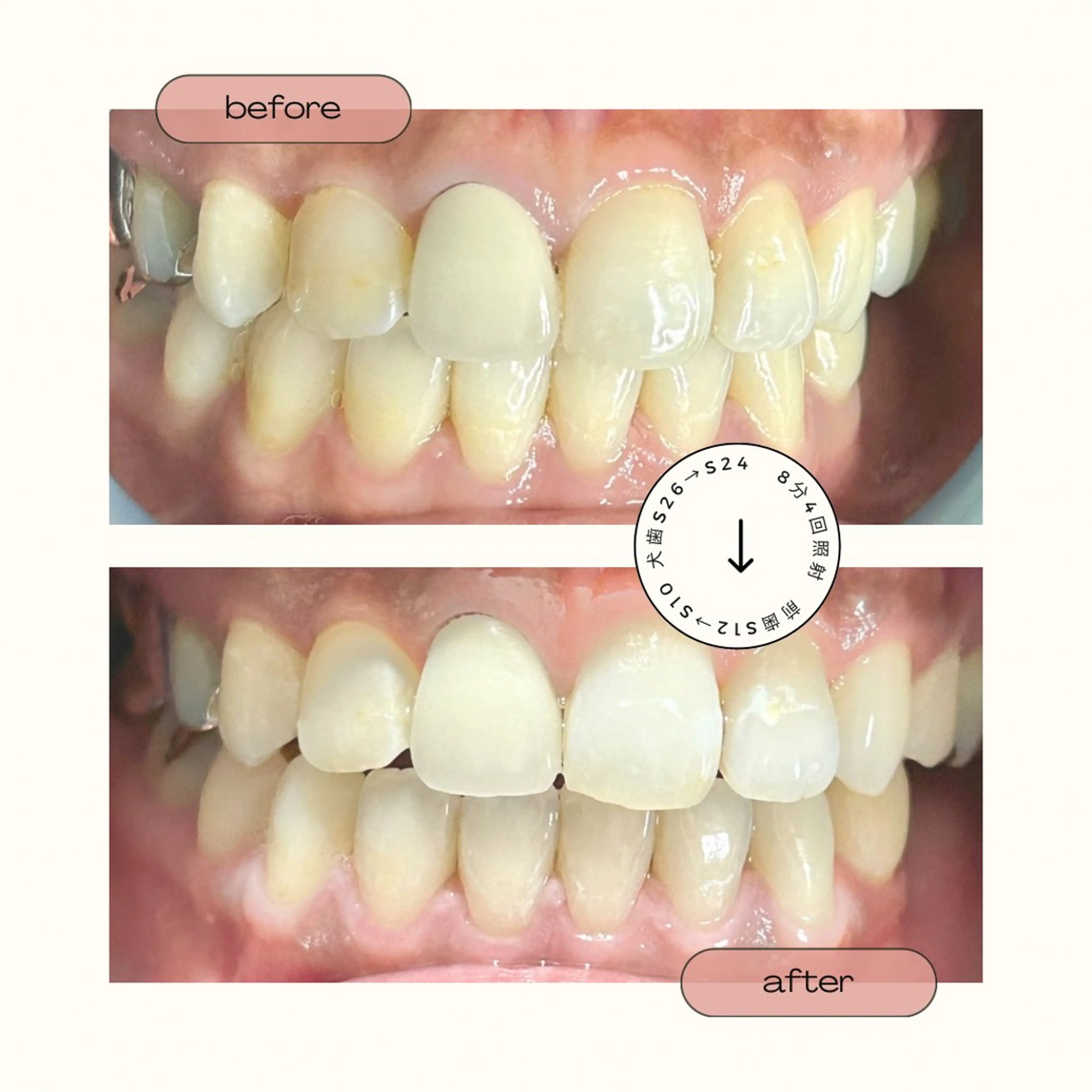 Shining Smileのその他イメージ