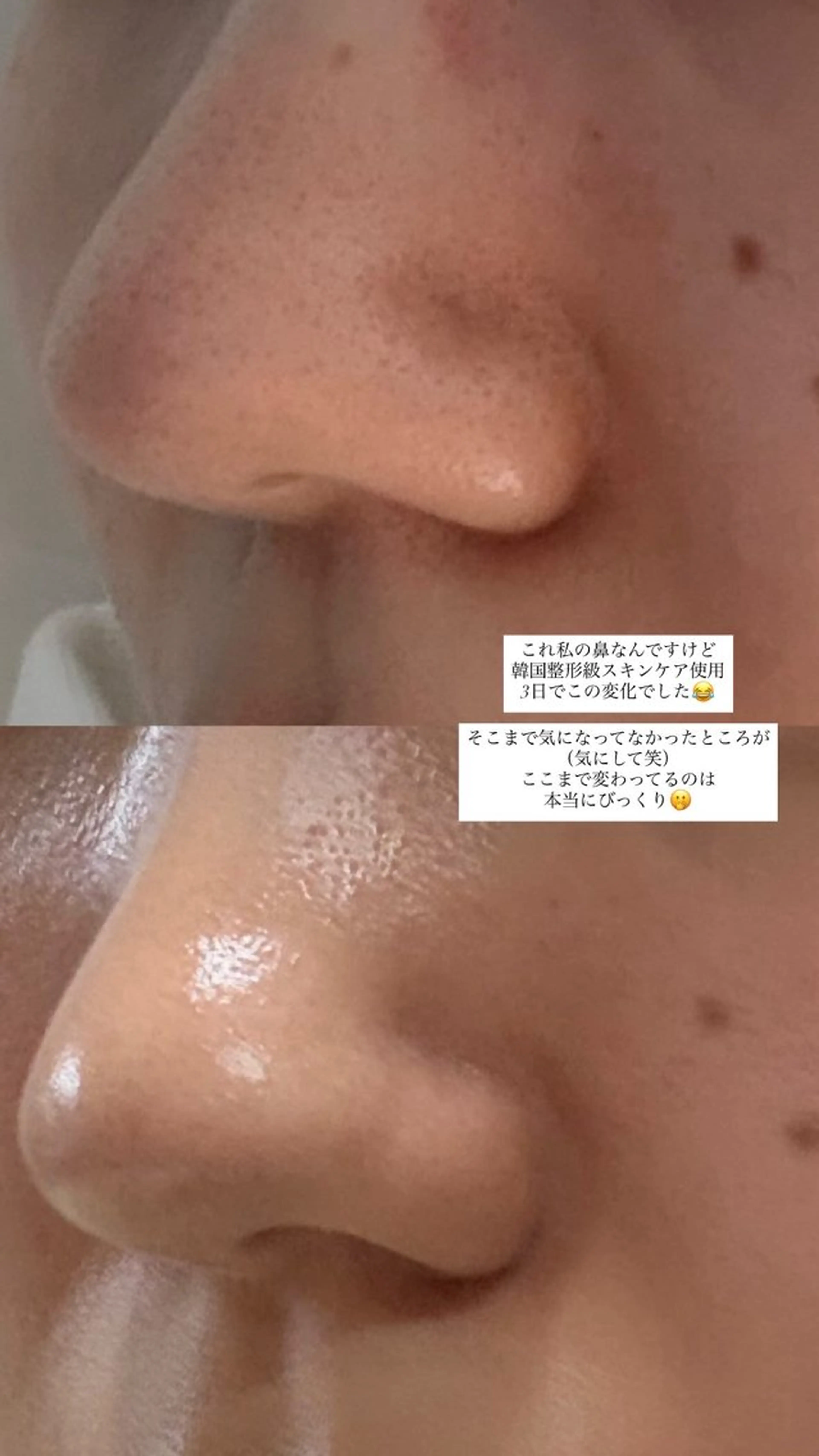 【vidyto】ヴィディトゥ所属・肌管理サロン vidyto　MOEのエステ・リラクイメージ