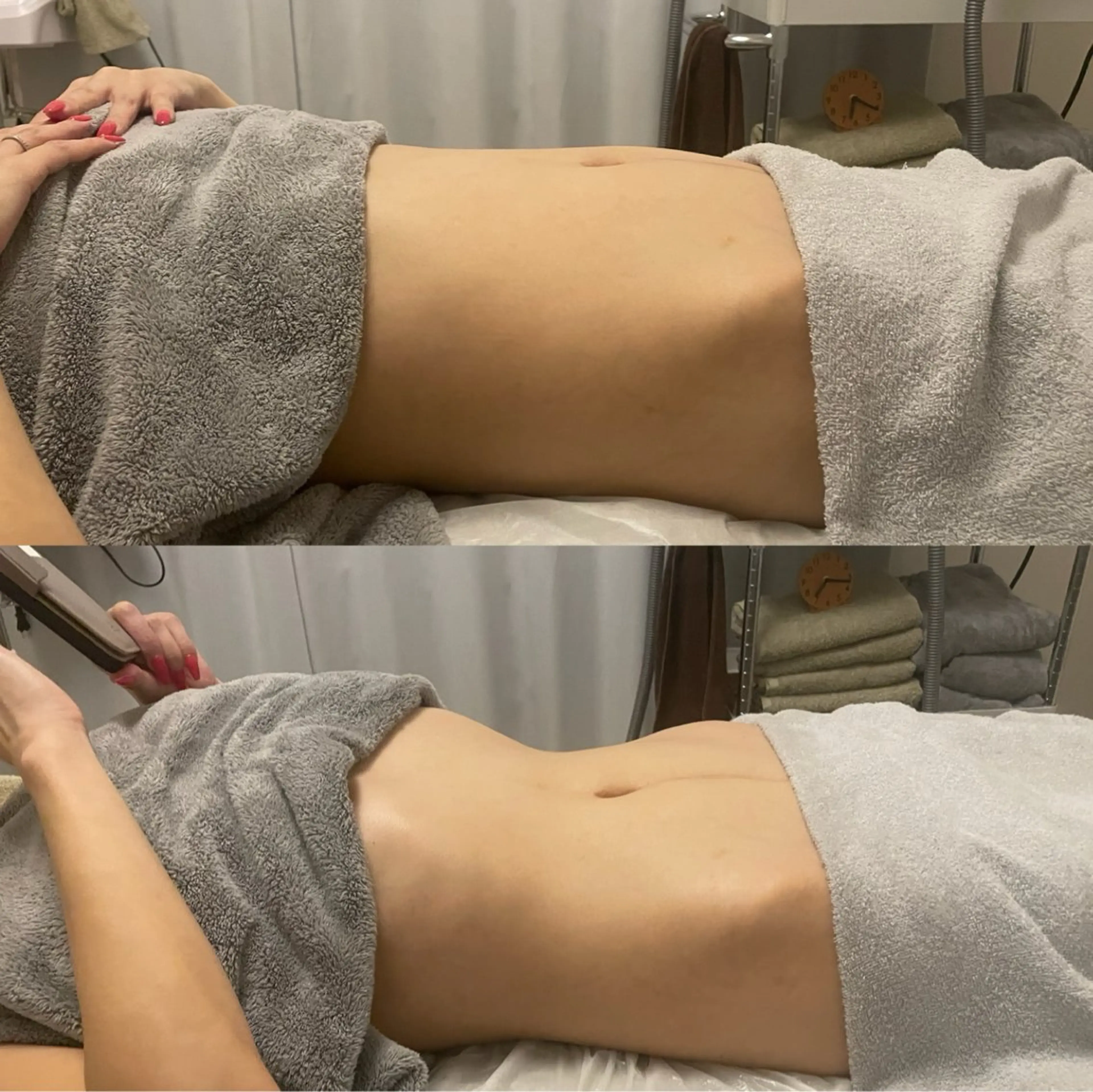 その他 Kanaloa beauty salon所属・腸もみ・メンズ脱毛・ 毛穴洗浄〜カナロア〜のエステ・リラクイメージ