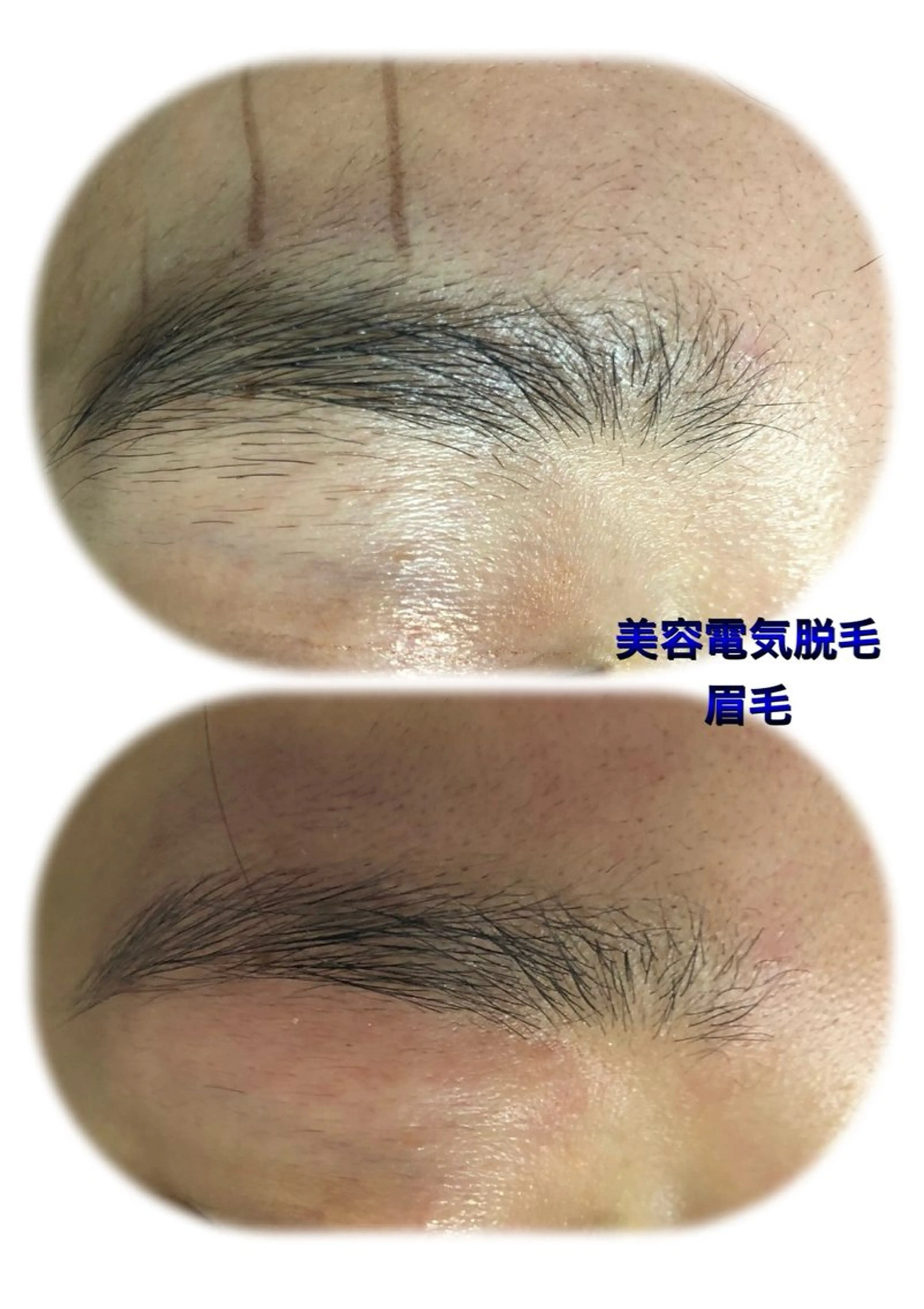 脱毛 HIRAMORI E.T.S所属・HIRAMORI E.T.Sのエステ・リラクイメージ